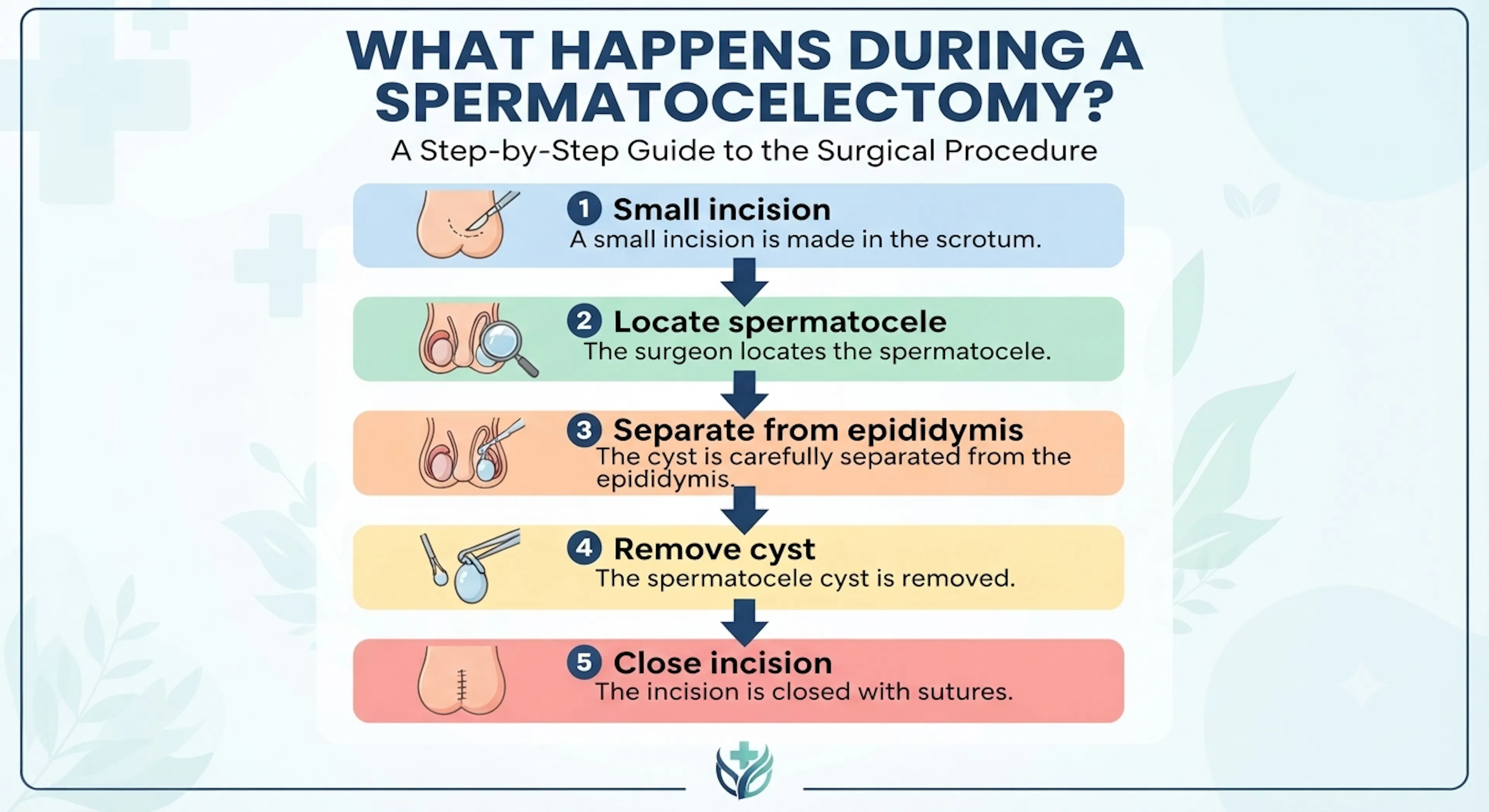 What Happens During a Spermatocelectomy? | CLS Health
