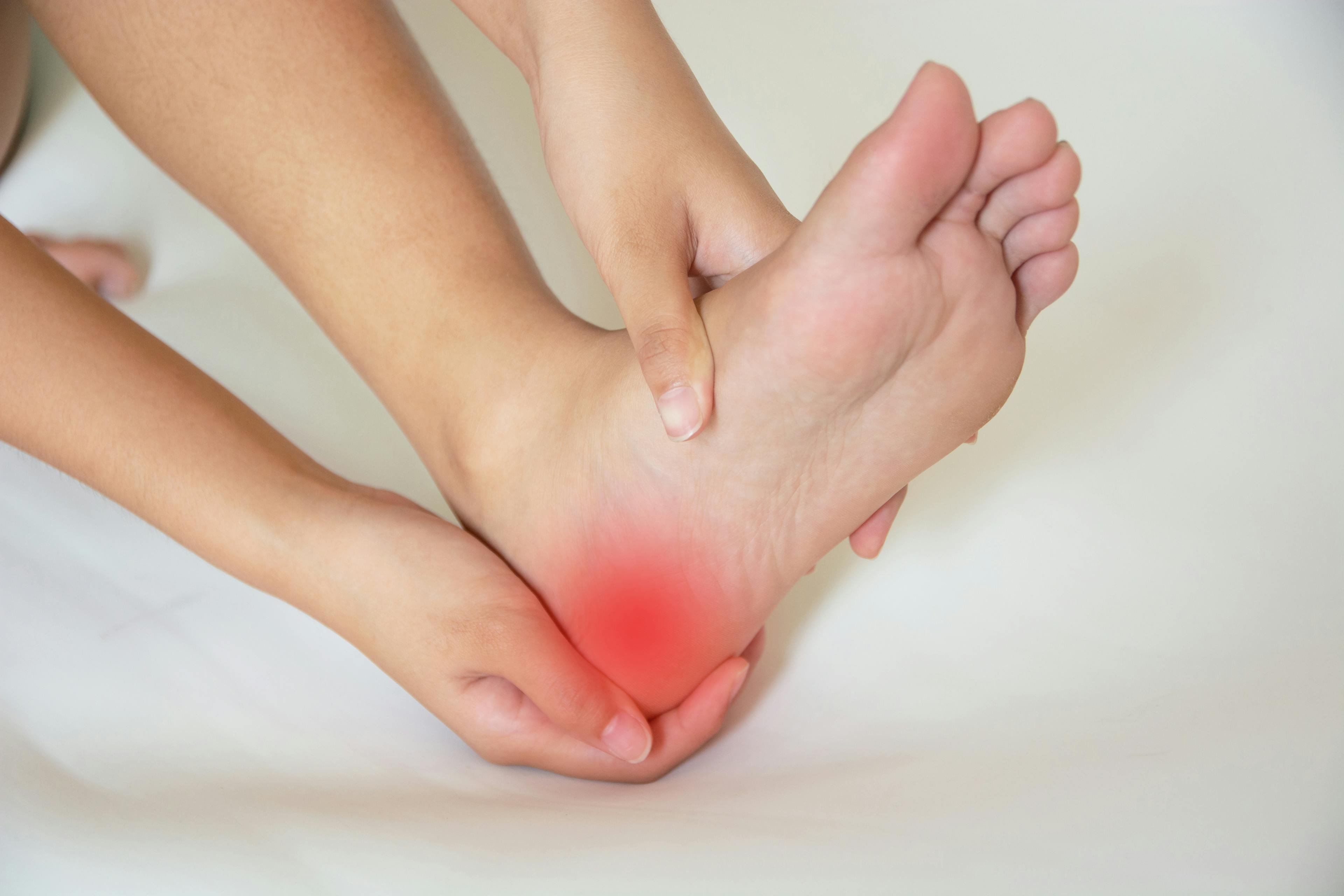 A person cupping their heel with redness indicating the location of pain