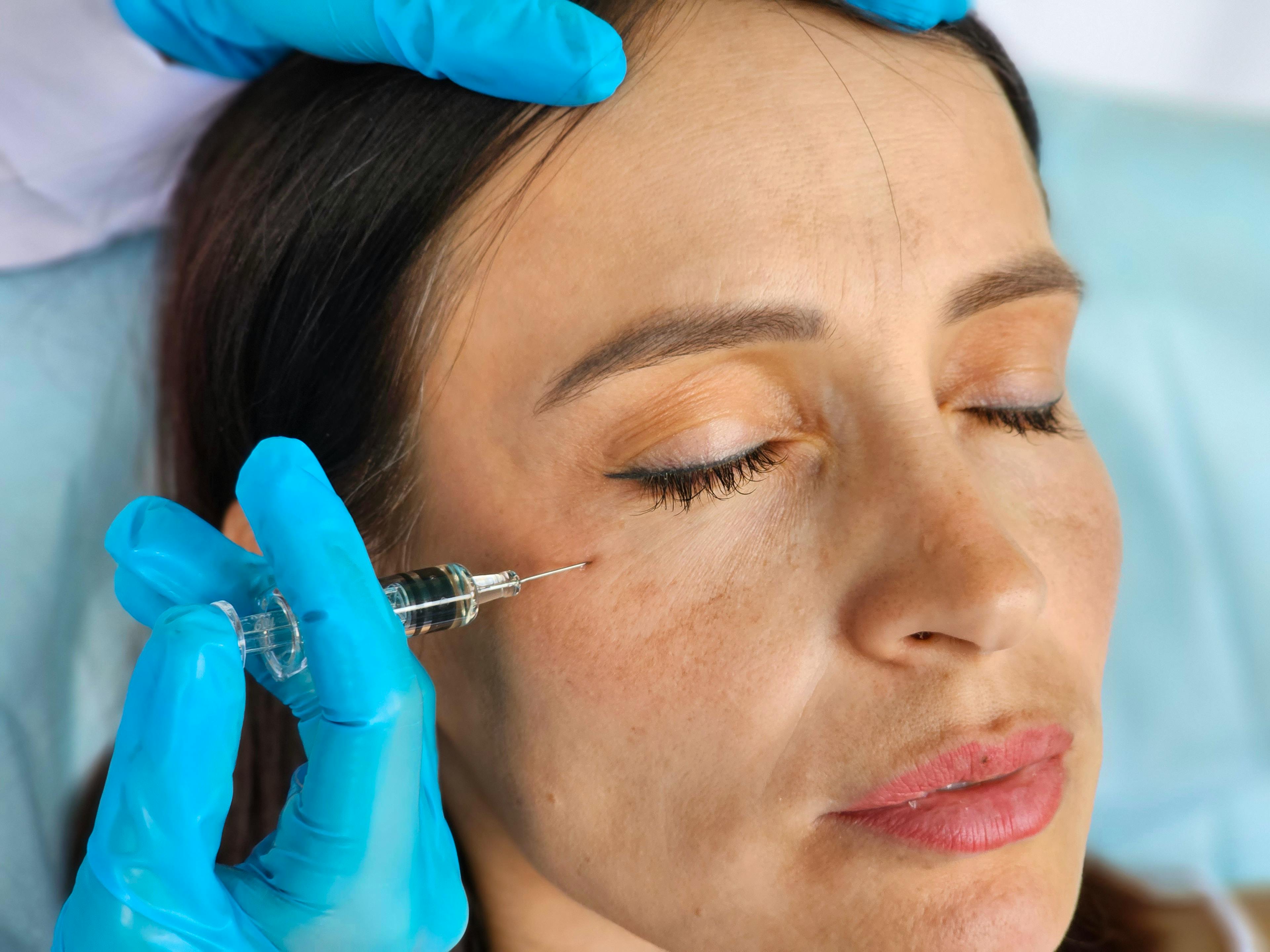A female patient receiving a Botox injection under her right eye.