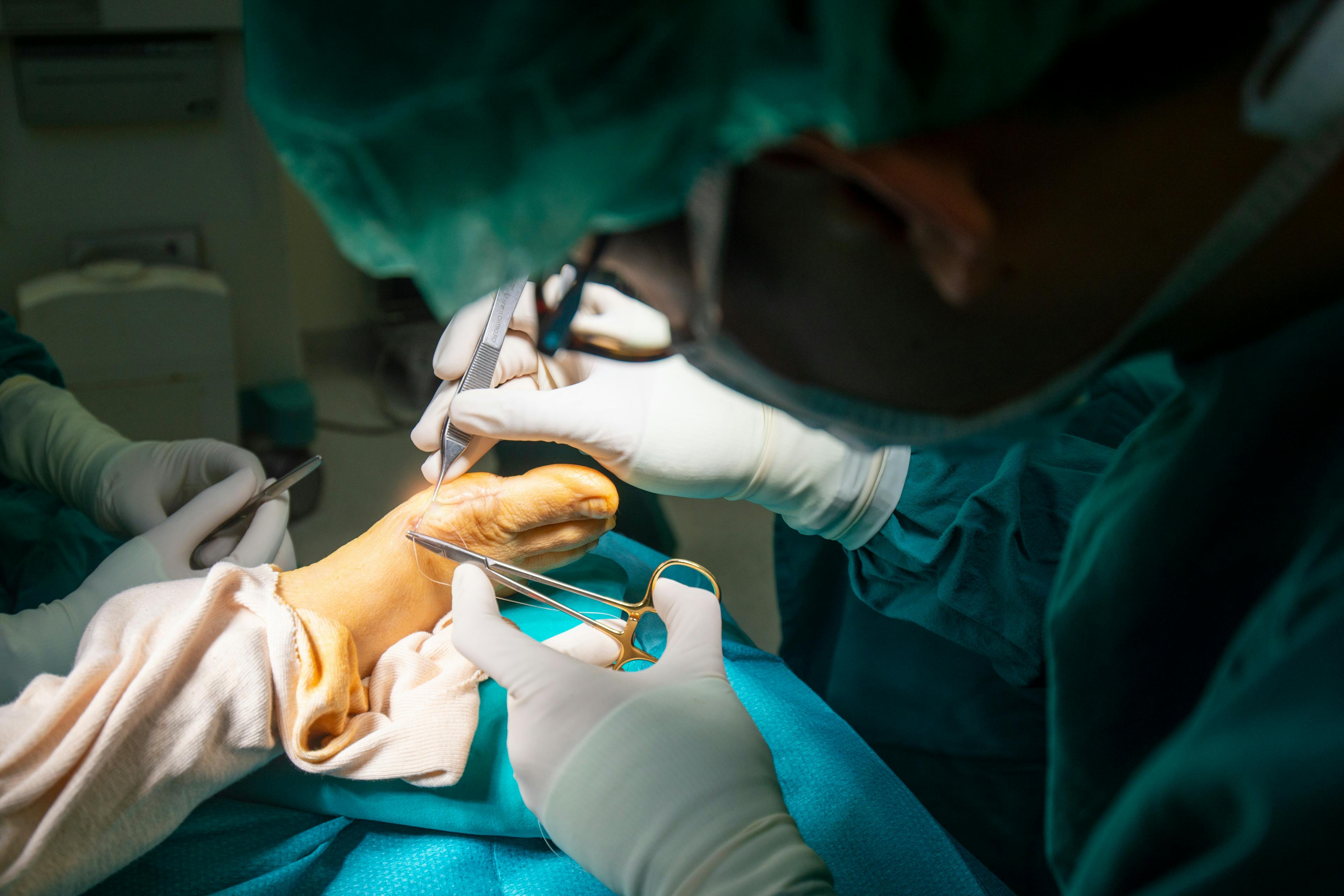 Surgeon performing bunion correction surgery on a patient's foot in a sterile operating room.