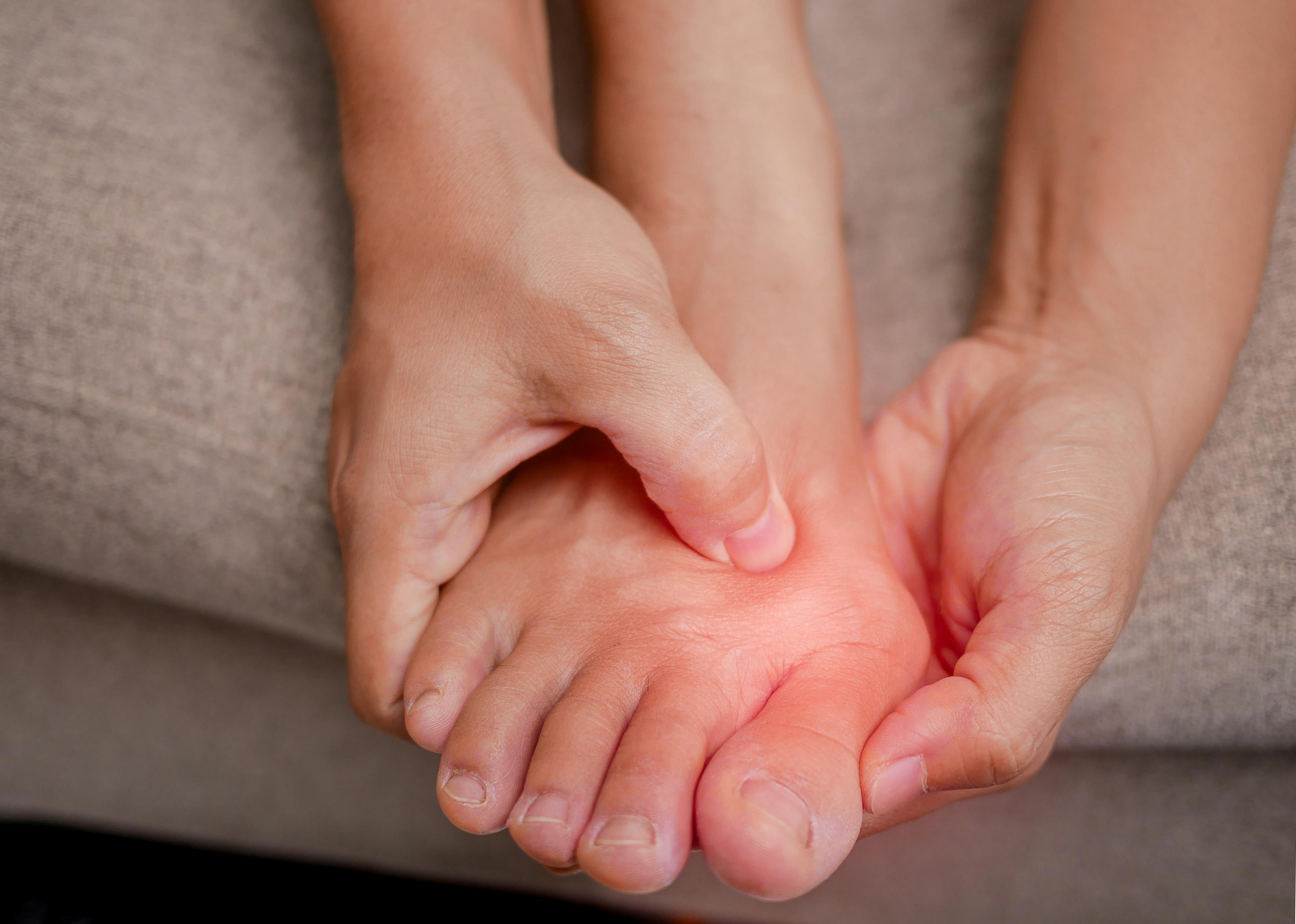 Closeup of person holding pained foot and massaging her bunion to relieve pain. Swollen bunion at the edge of the big toe.