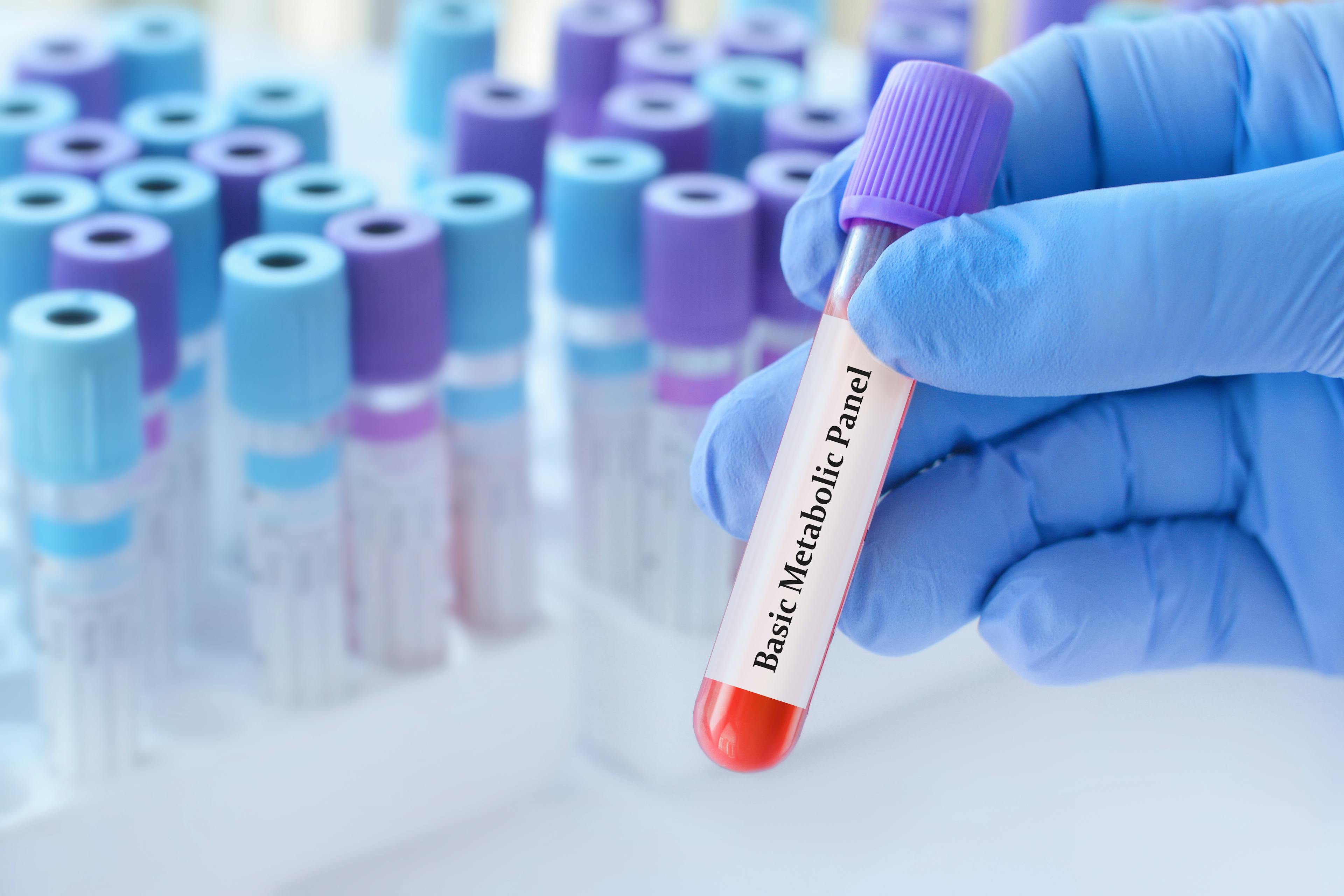 Doctor holding a test blood sample tube with basic metabolic panel test against background of medical test tubes.