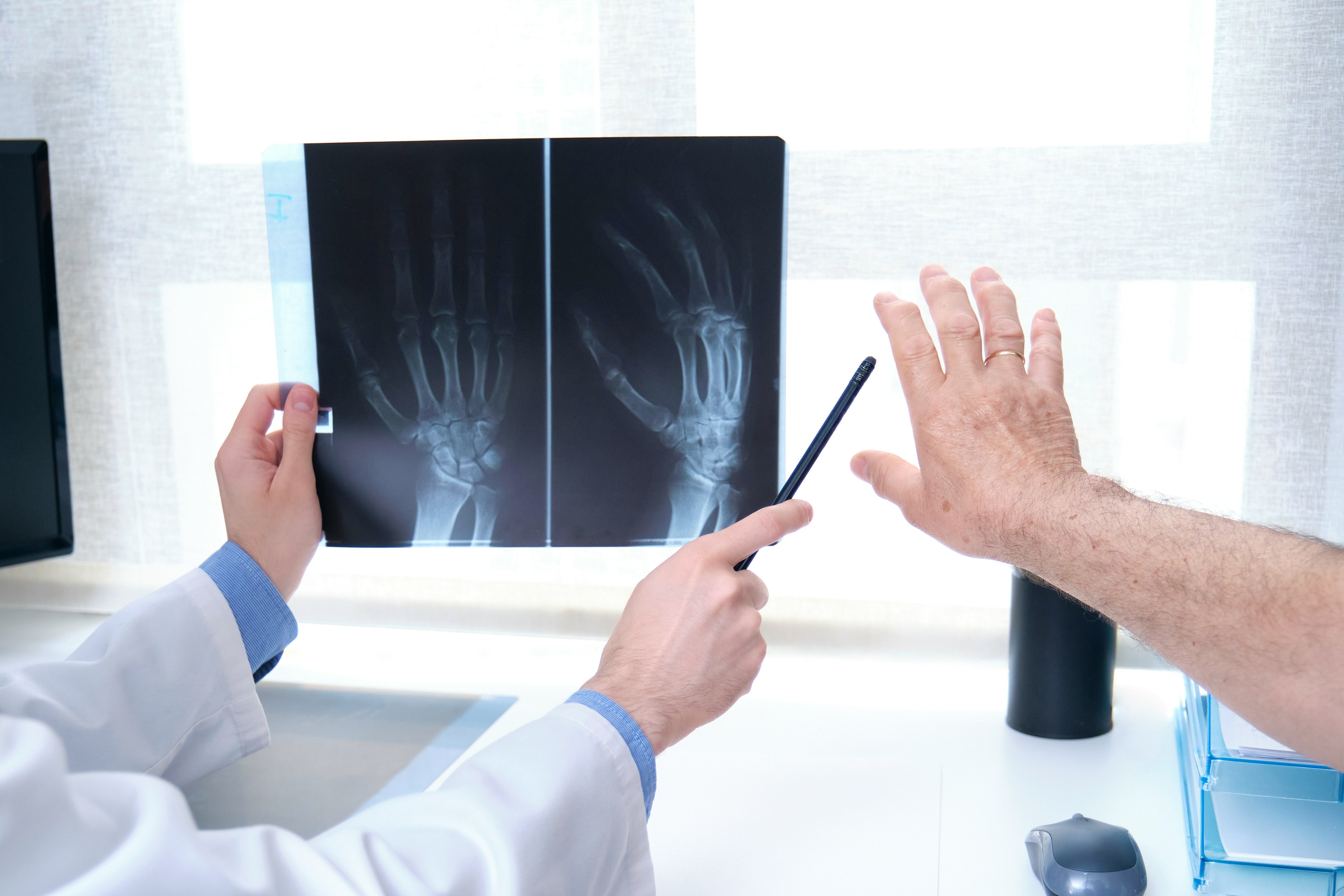 Young doctor examining x-ray of hands of a senior patient with arthritis. Radiography of a hand.