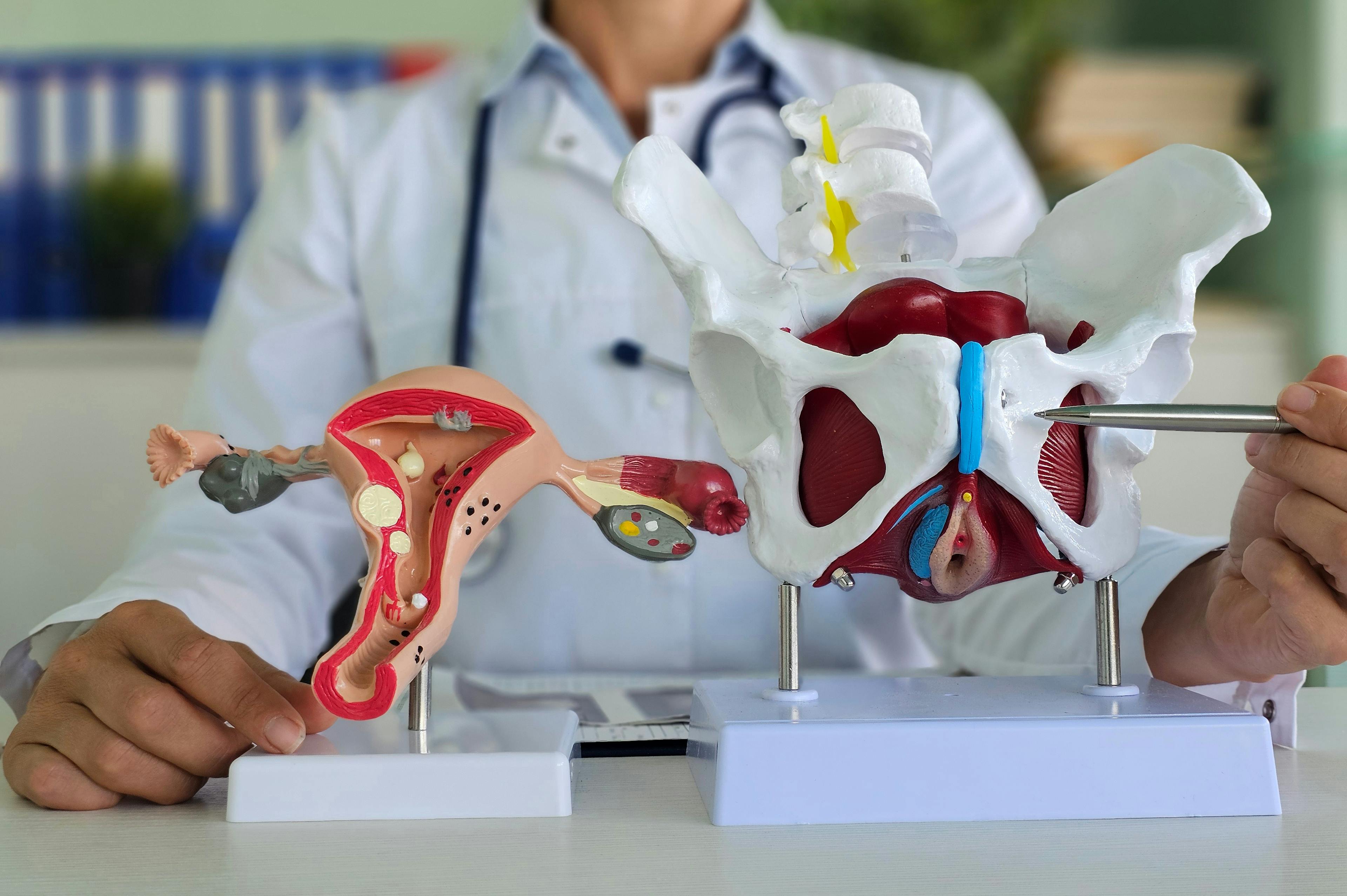 Gynecologist holds a model of the pelvic bones and the anatomy of the uterus