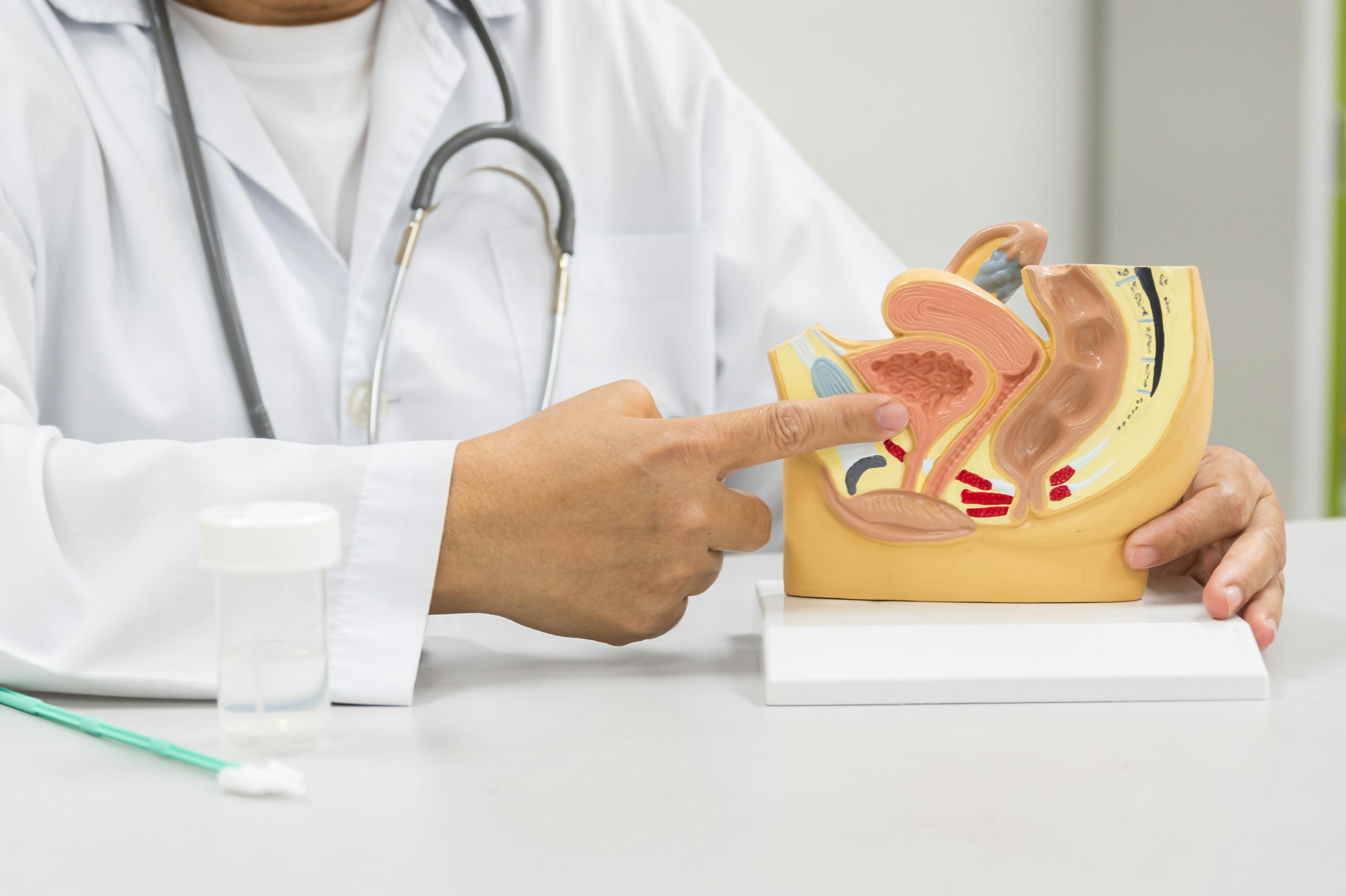 Gynecologist teaching patient for vaginal and cervix pap smear check-up in the obstetrics and gynecology department.