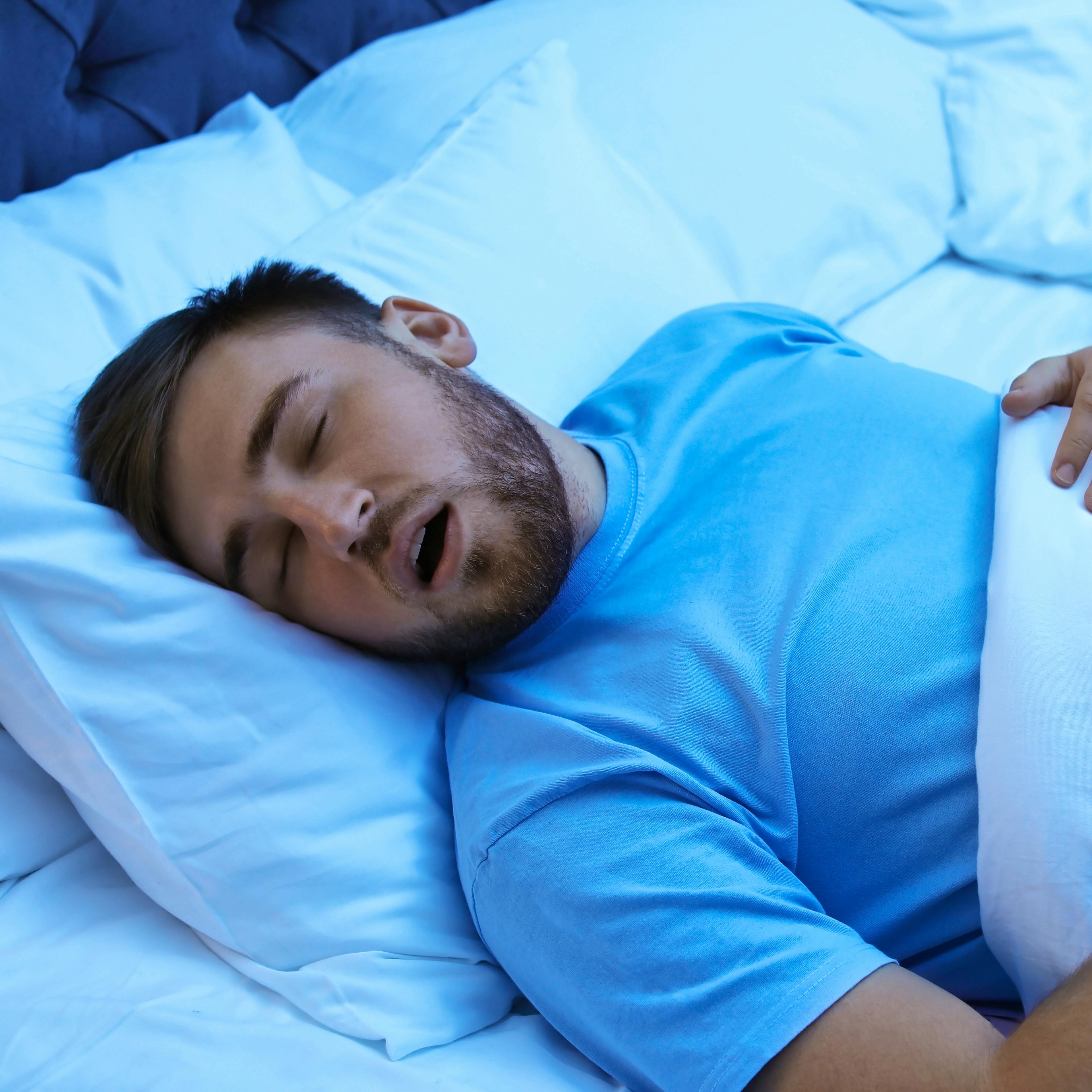 A man is snoring due to sleep apnea.