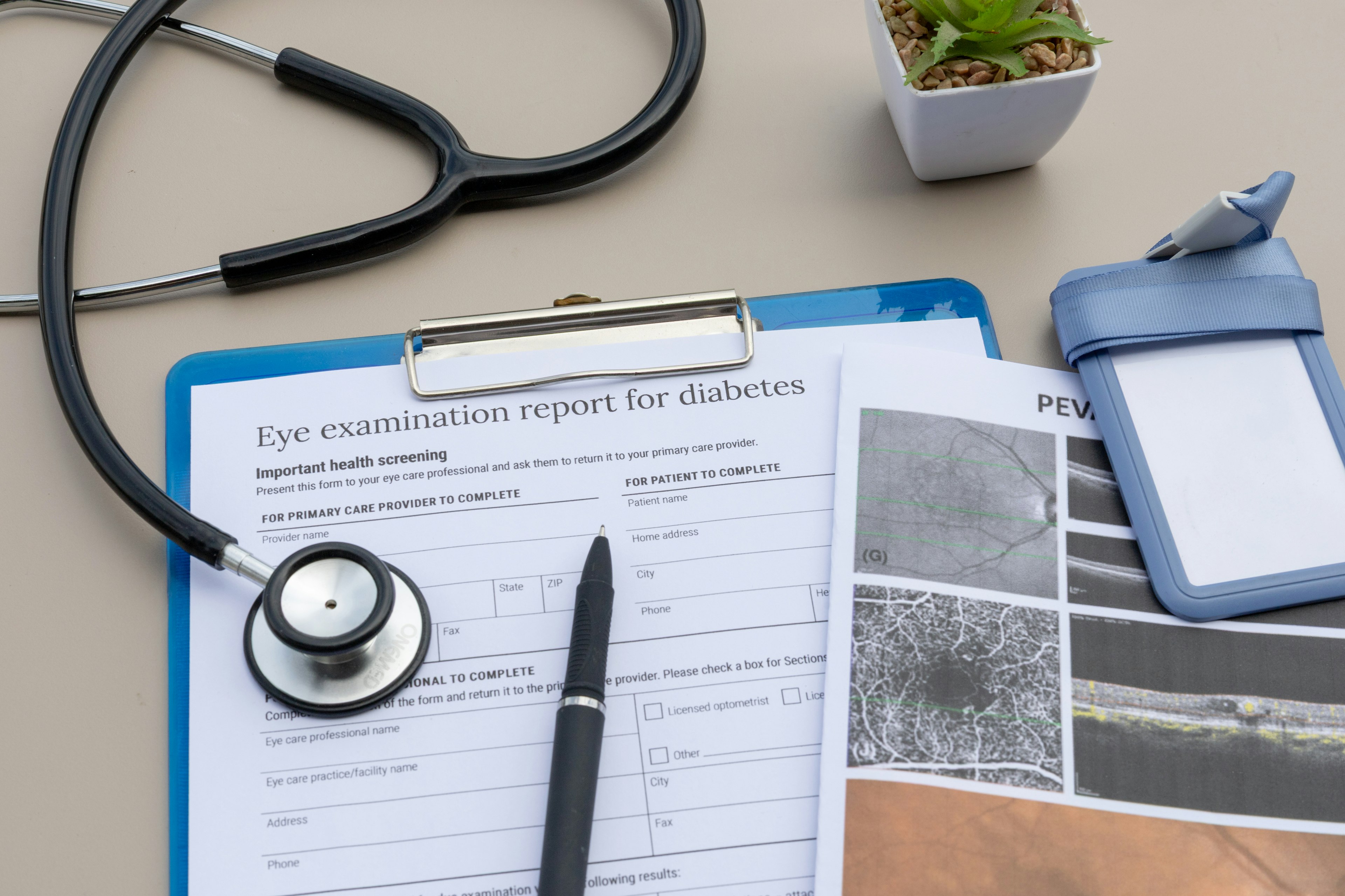 A clipboard with a form for diabetic eye exams at an eye doctor's office next to a stethoscope.
