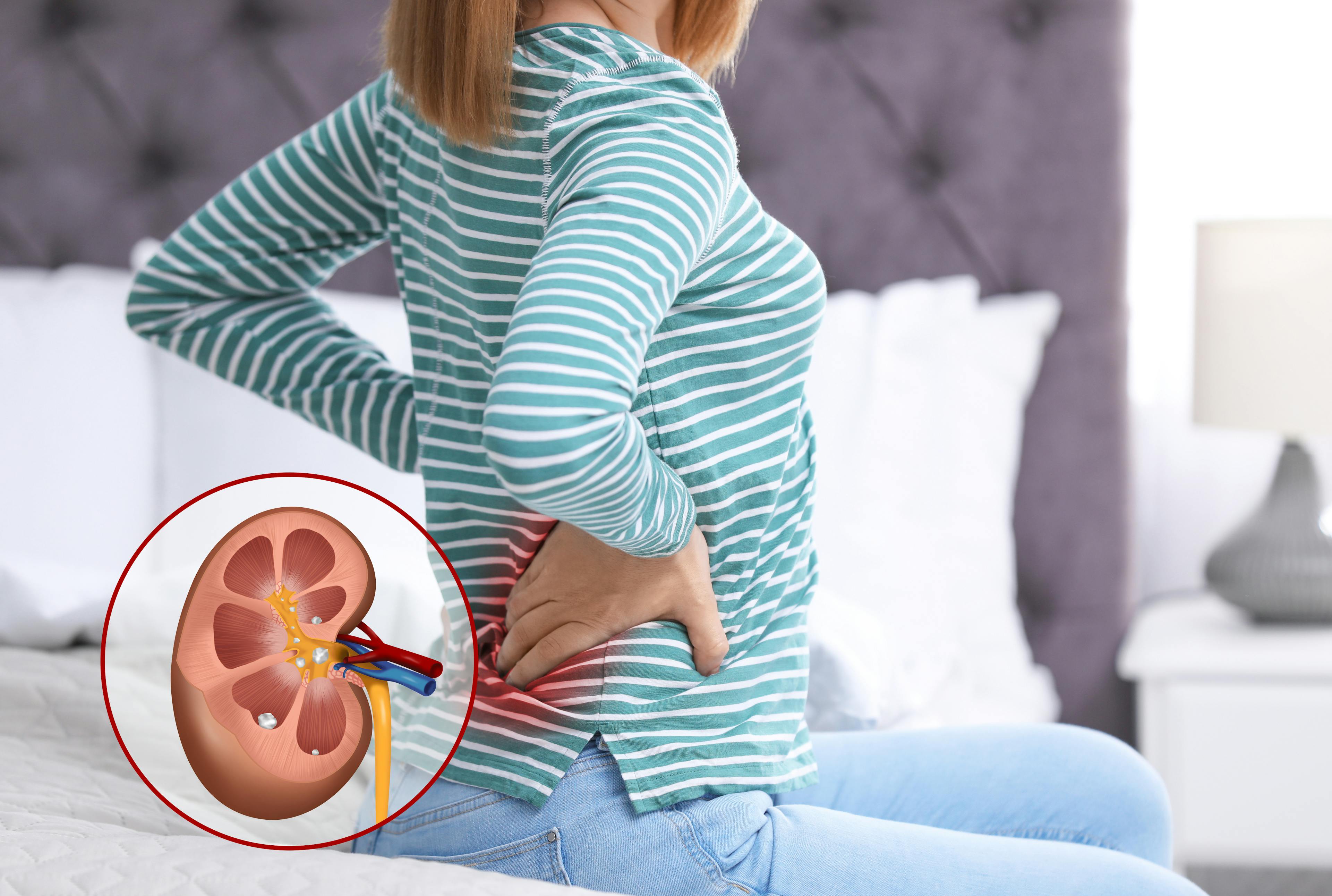 Women holding her lower back due to kidney pain