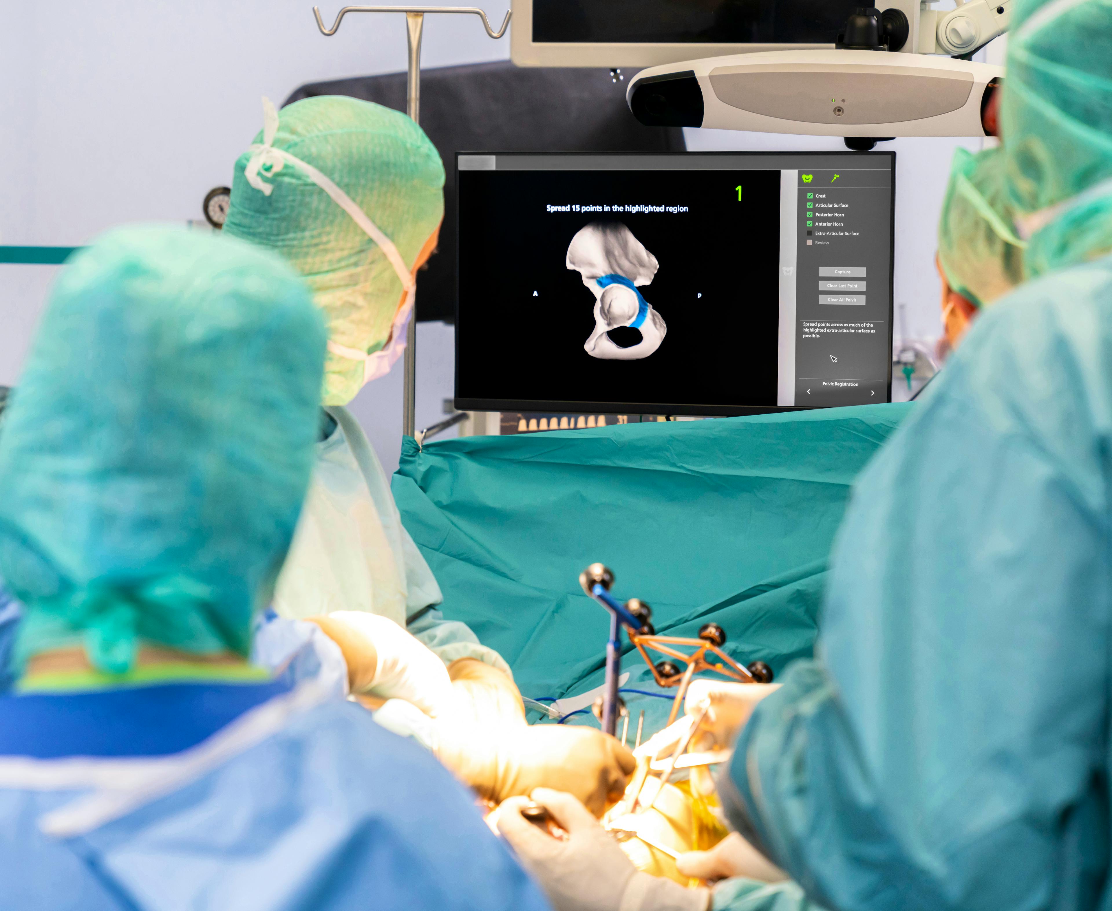 Surgeons performing robotic-assisted hip replacement using 3D navigation technology