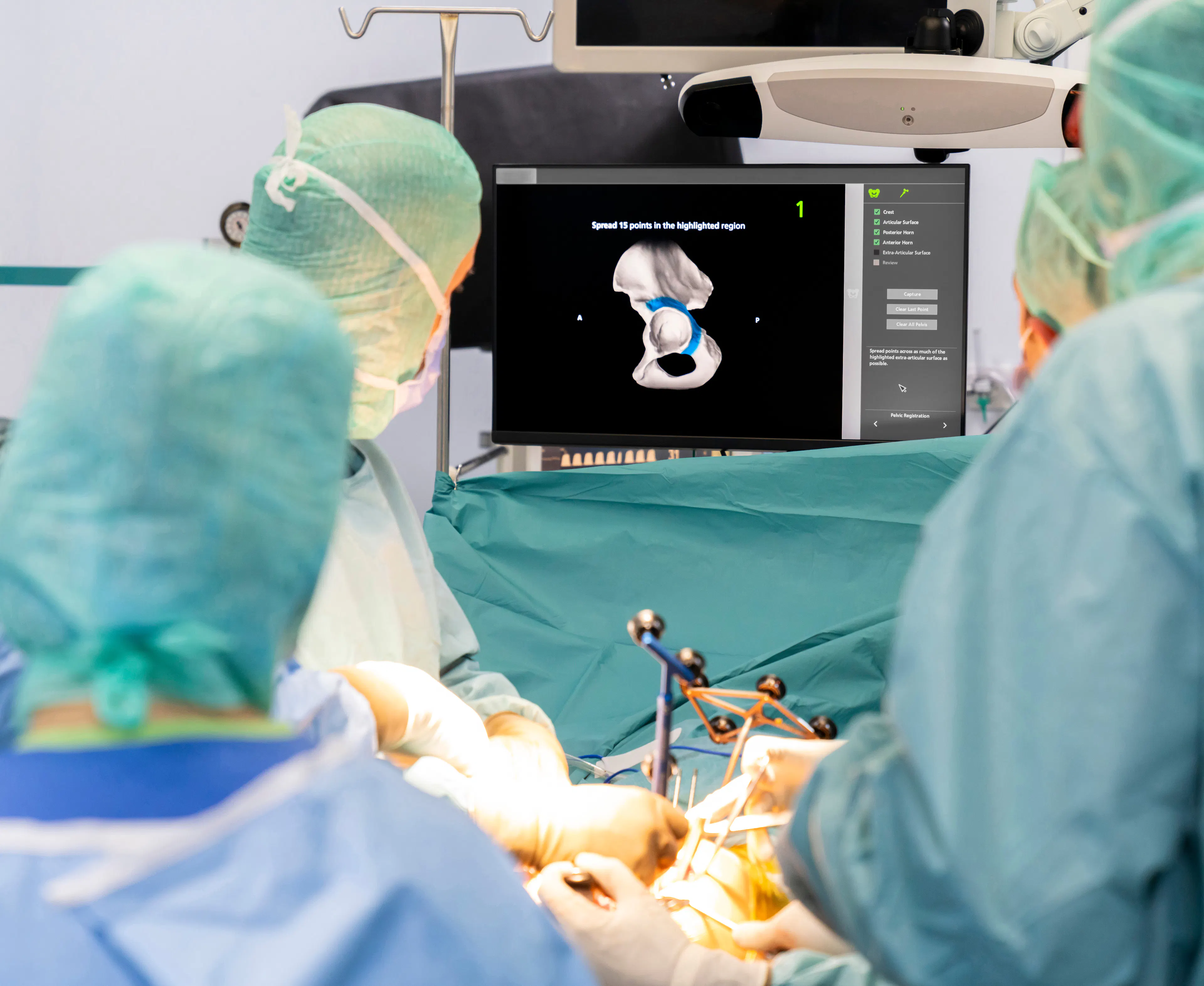 Surgeons performing robotic-assisted hip replacement using 3D navigation technology