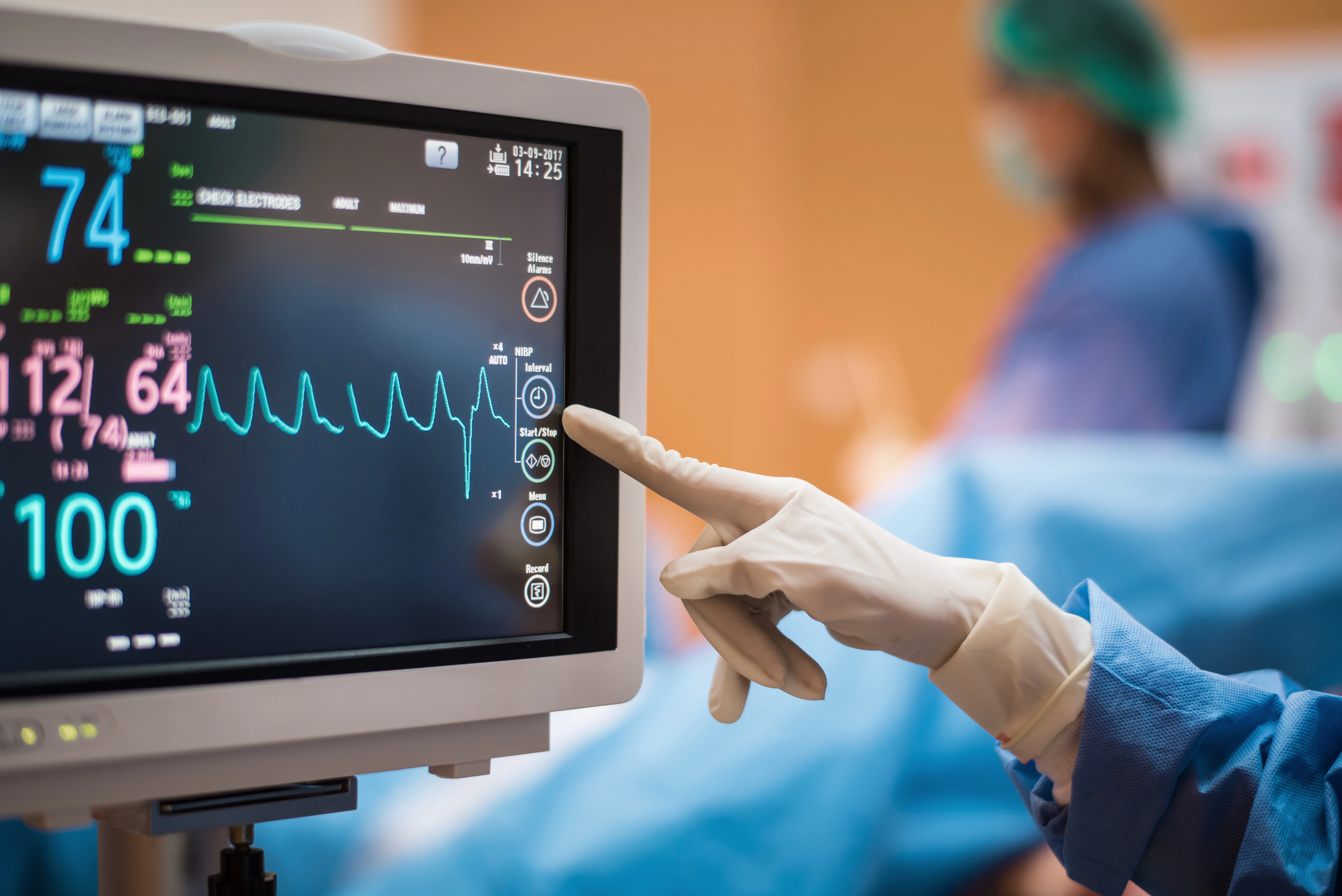 An electrocardiogram (ECG/EKG) is shown on a screen with a medical provider pointing at it.