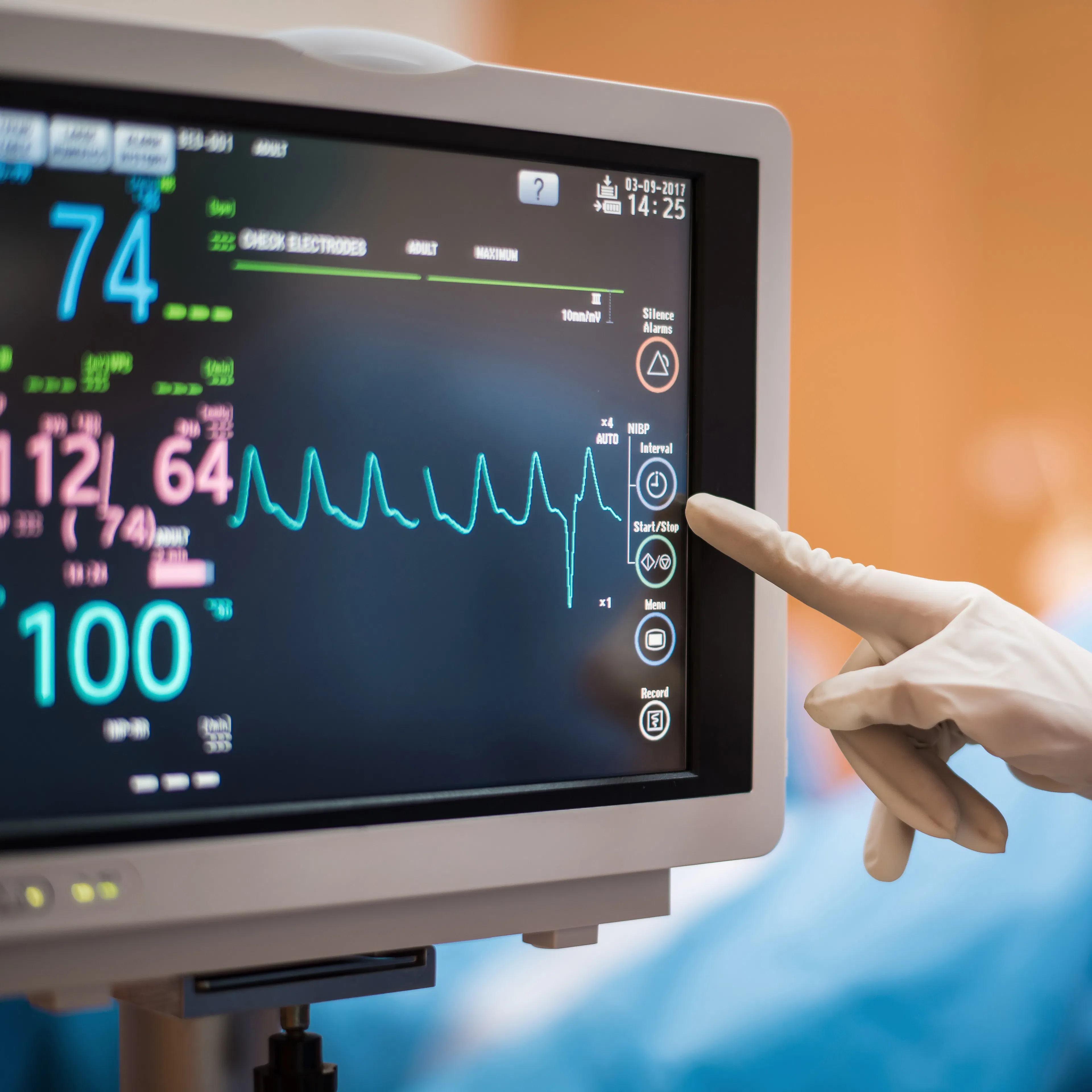 An electrocardiogram (ECG/EKG) is shown on a screen with a medical provider pointing at it.