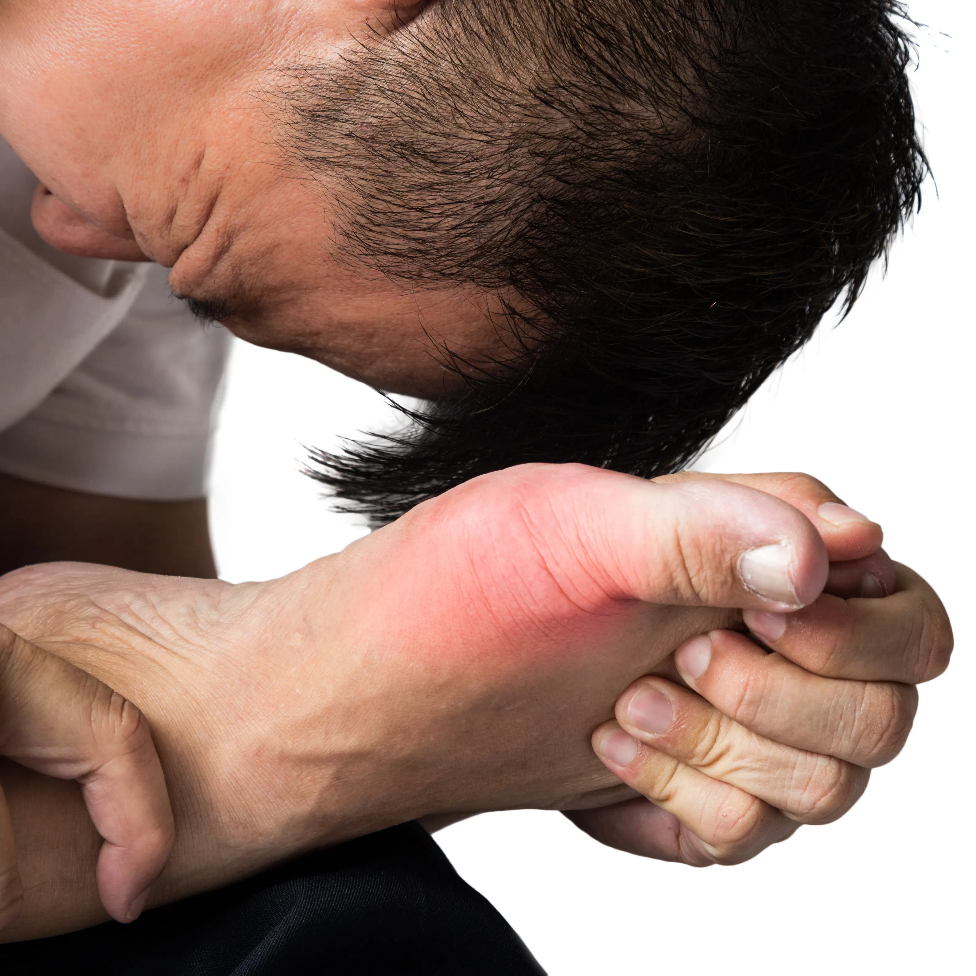 A man is bent over wincing in pain due to pain in his big toe resulting from gout.