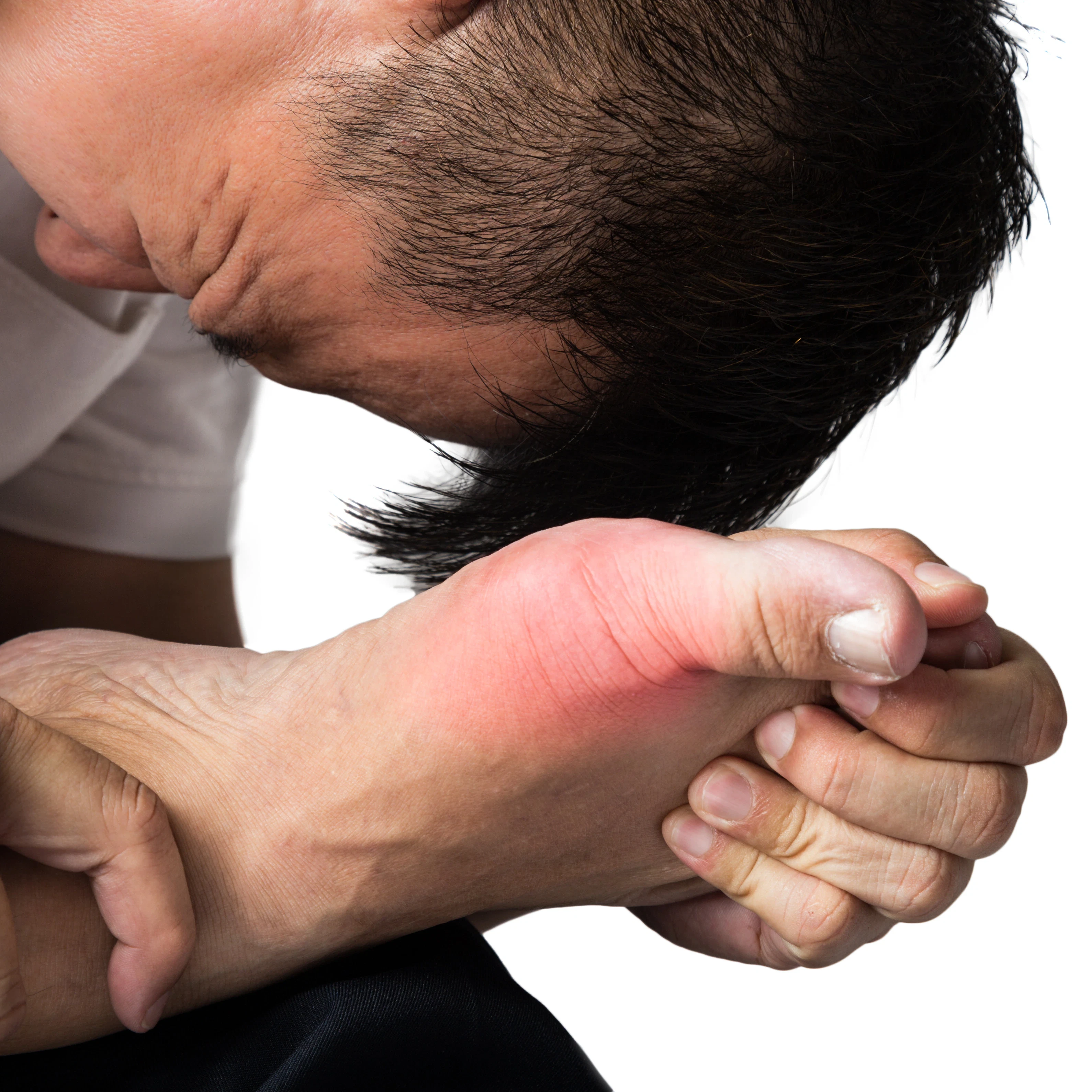 A man is bent over wincing in pain due to pain in his big toe resulting from gout.