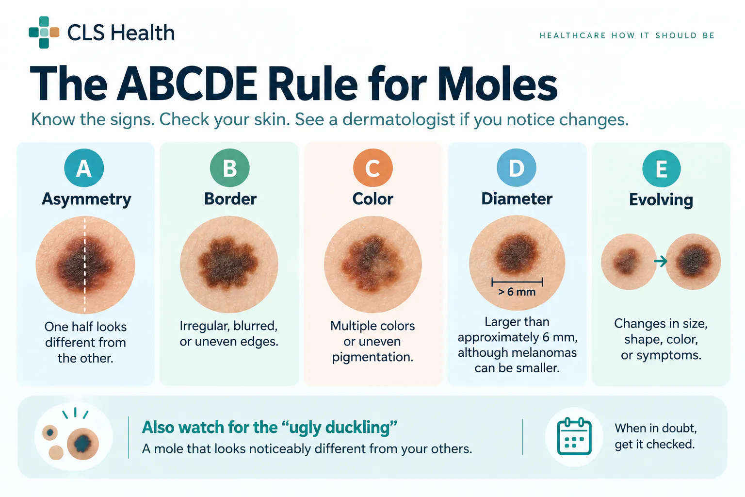 ABCDE Guide for Checking Moles for Possible Signs of Melanoma | CLS Health