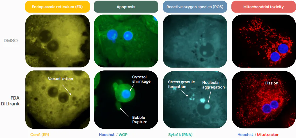 Fluorescence images of primary human hepatocytes treated with a control and with a hepatotoxic drug, showing vacuolization in the endoplasmic reticulum, cytosol shrinkage and bubble rupture in apoptosis, stress granules in RNA staining, and mitochondrial fission.