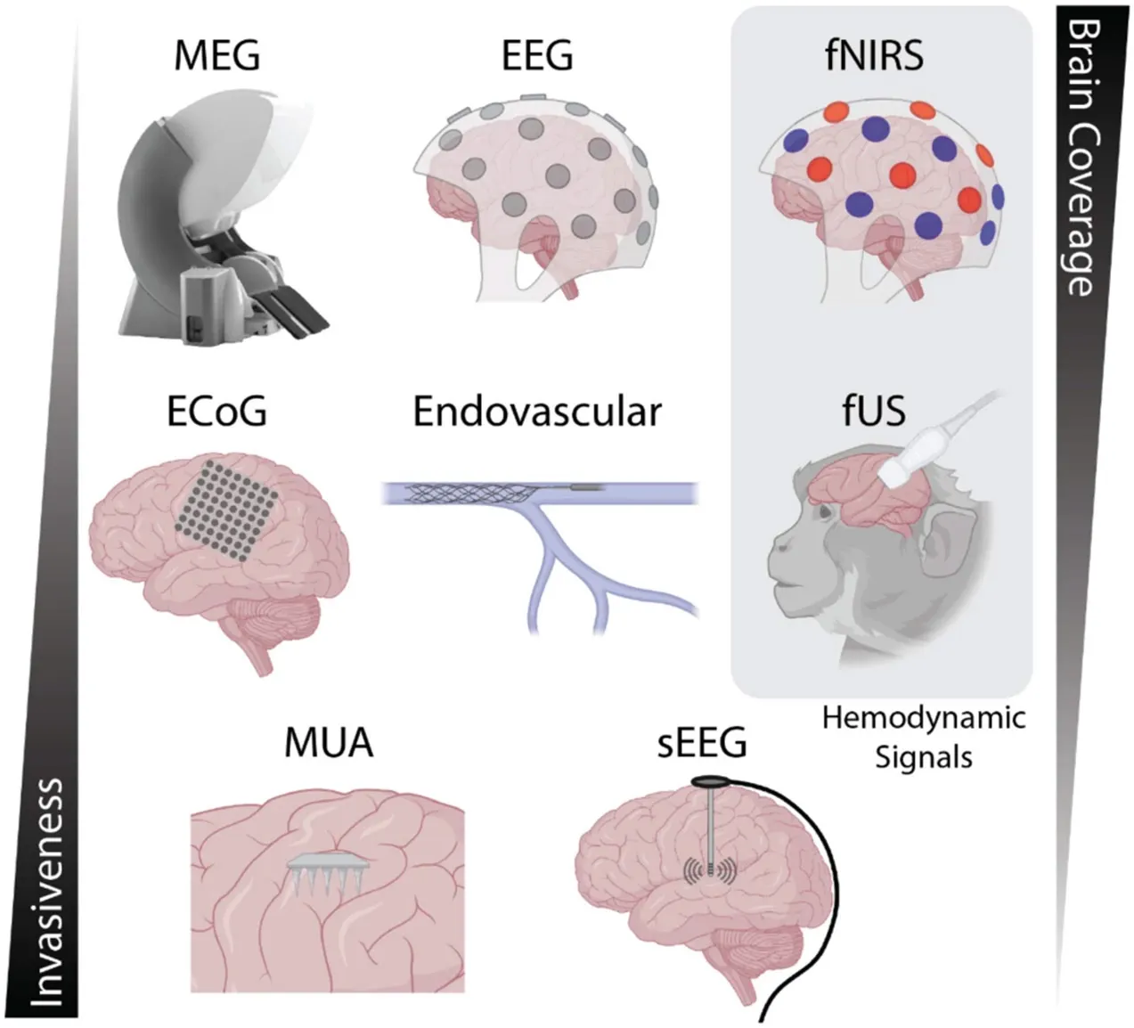 Comparison of brain-recording methods