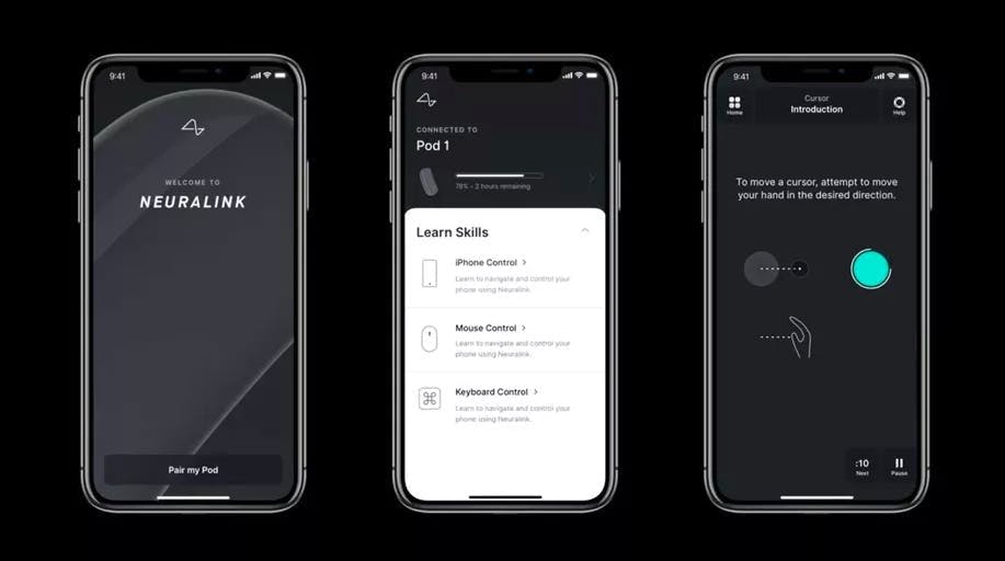 Neuralink mobile app preview