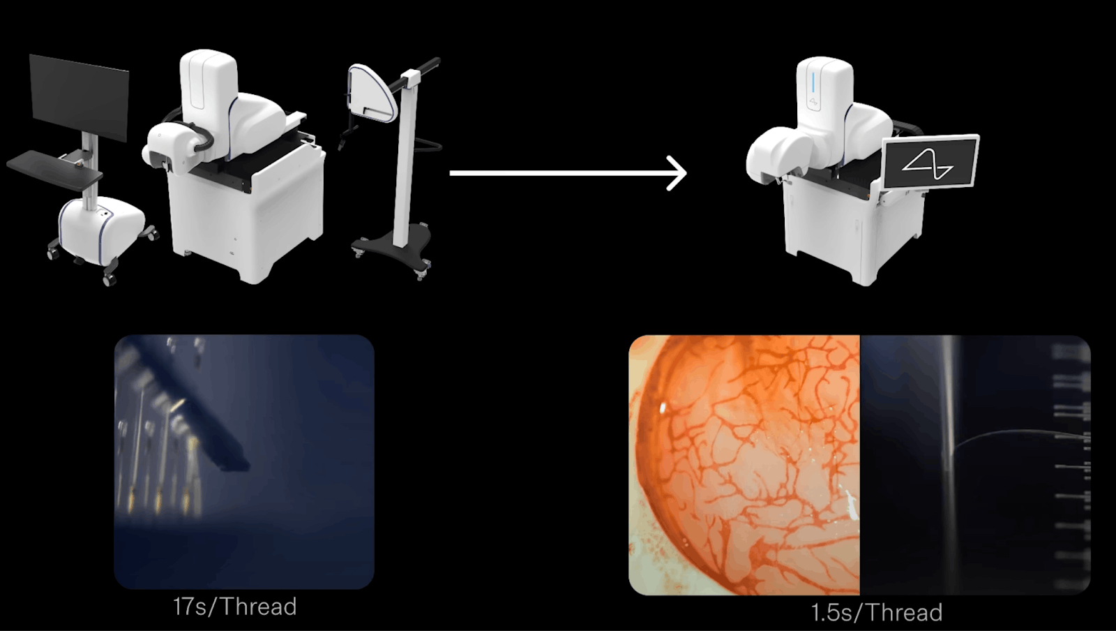 Cycle time improvments on the Neuralink robot