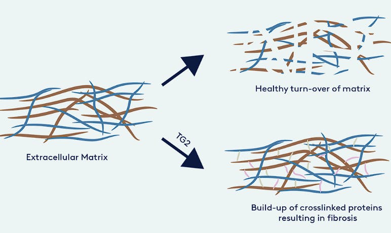 Isterian’s inhibitors target transglutaminase 2 (TG2)