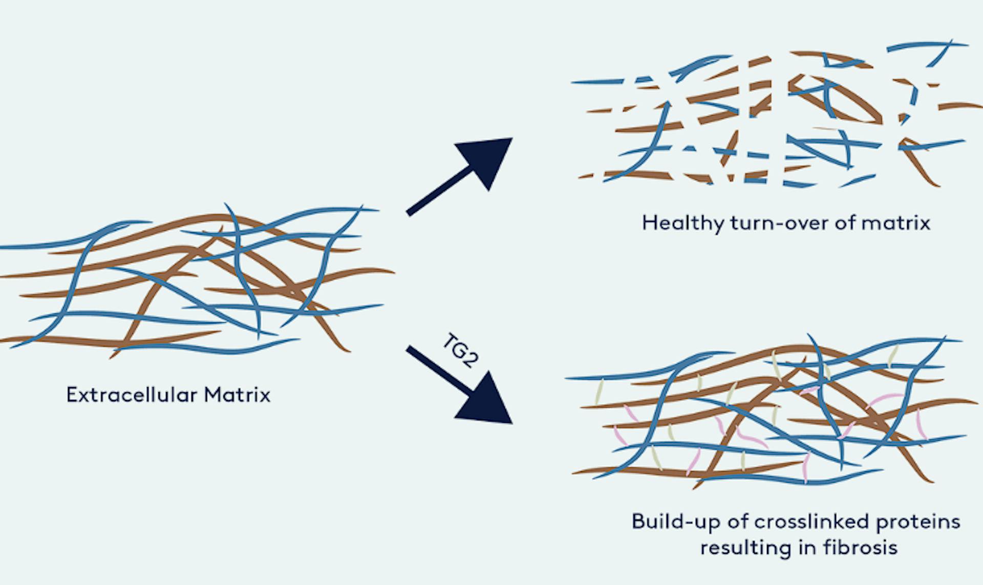 Isterian’s inhibitors target transglutaminase 2 (TG2)