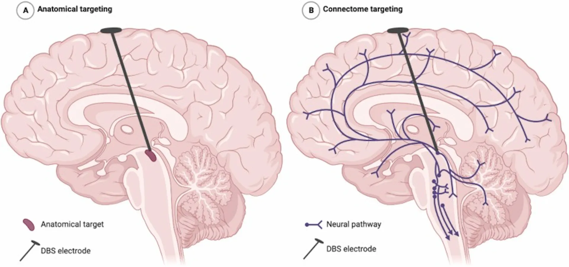 Side-by-side sagittal brain diagrams compare anatomical targeting (left) and connectome targeting (right)