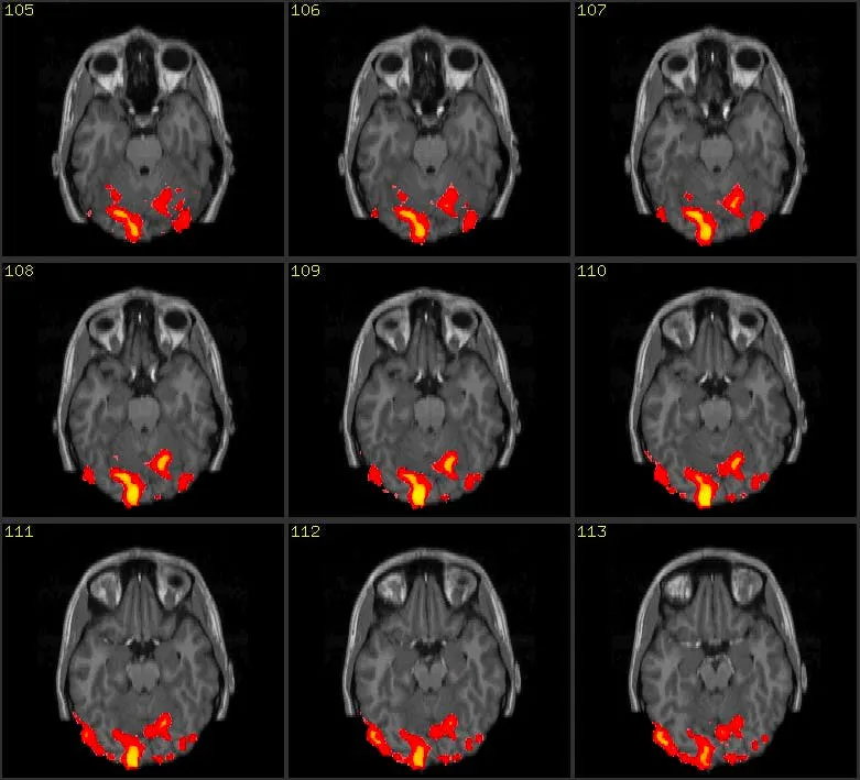 Grid of nine fMRI brain slices with activated regions highlighted in red and yellow