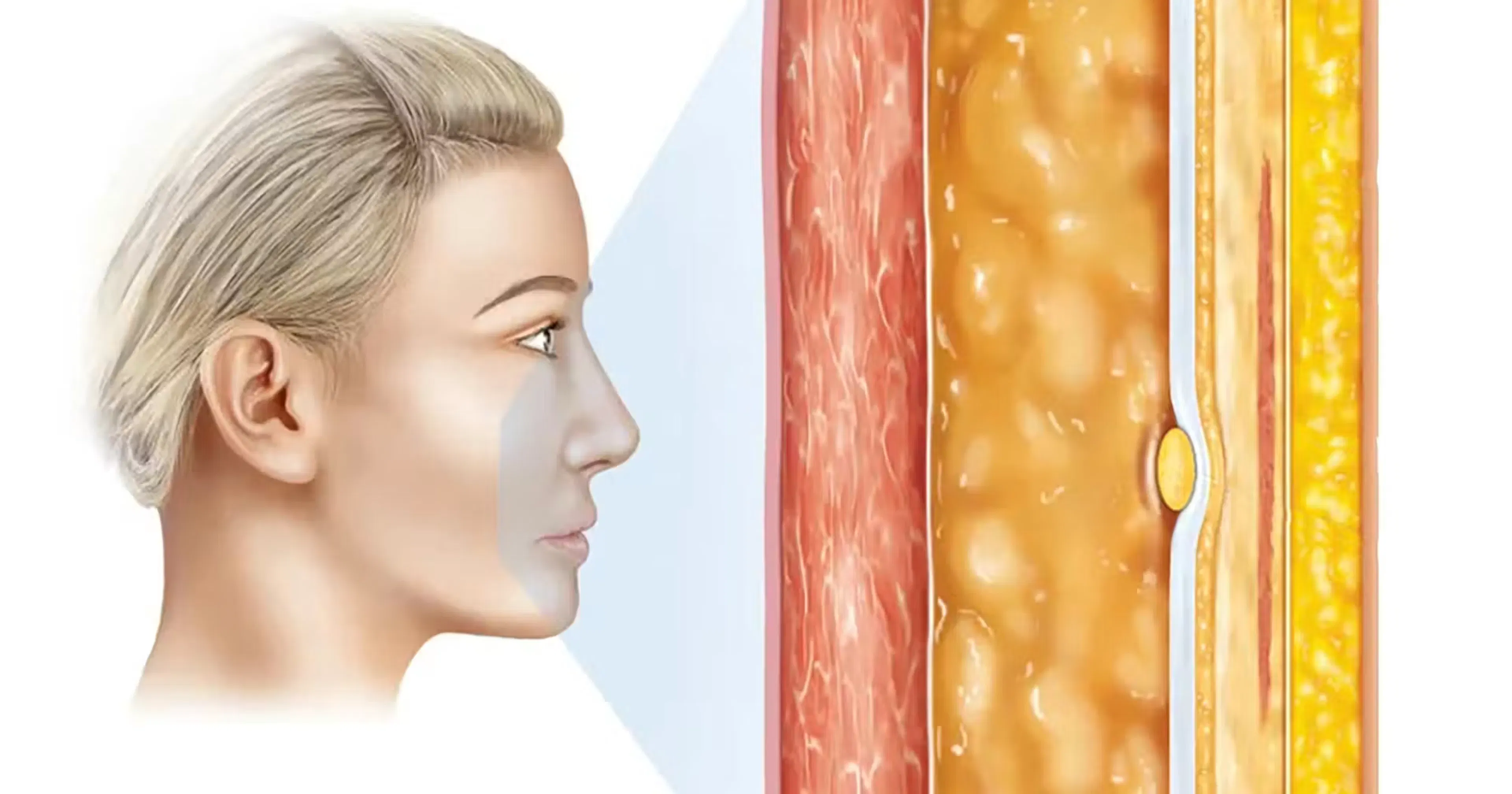 Facial Adipose Tissue diagram