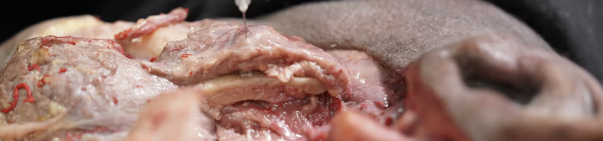 Neuromodualtor Treatments: Masseter Hypertrophy