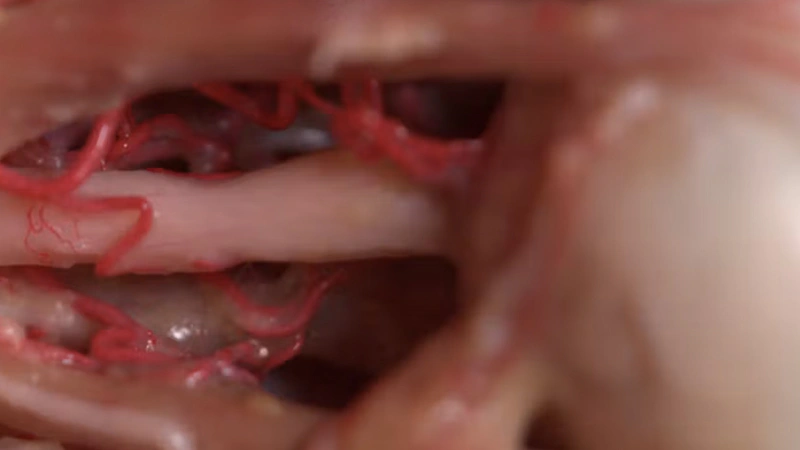Basic Anatomy and Danger Zones: Periorbital