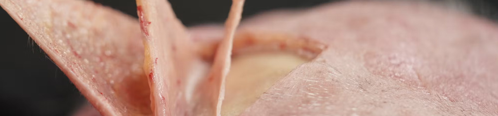 Layers of the Scalp
