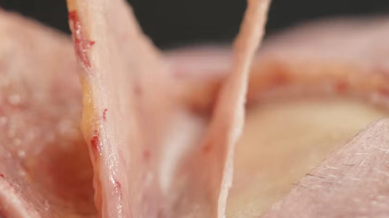 Layers of the Scalp