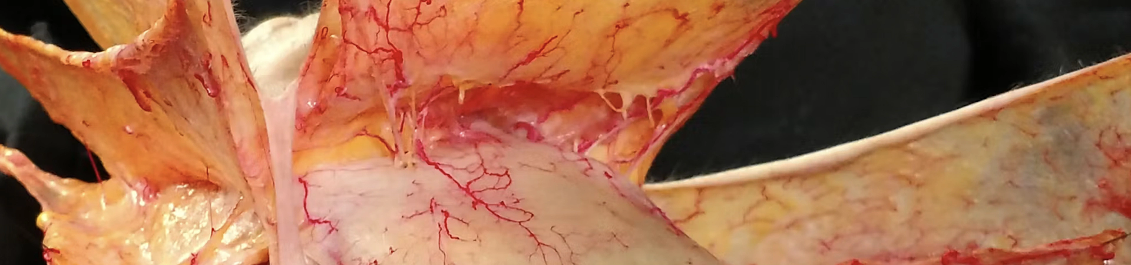 Layers of the Face