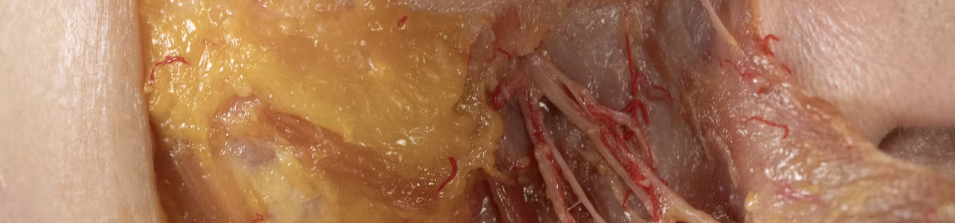 Basic Anatomy and Danger Zones: Medial Midface