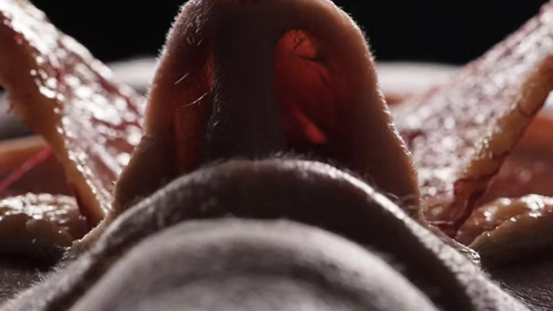 Basic Anatomy for Neuromodulator Treatments: Nasalis Muscle