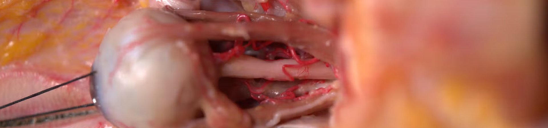 Extended Anatomic Review: The Ophthalmic Artery