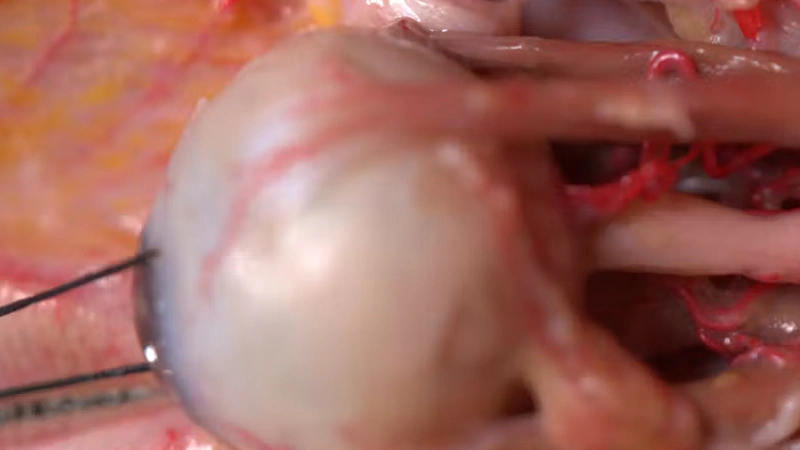 Extended Anatomic Review: The Ophthalmic Artery