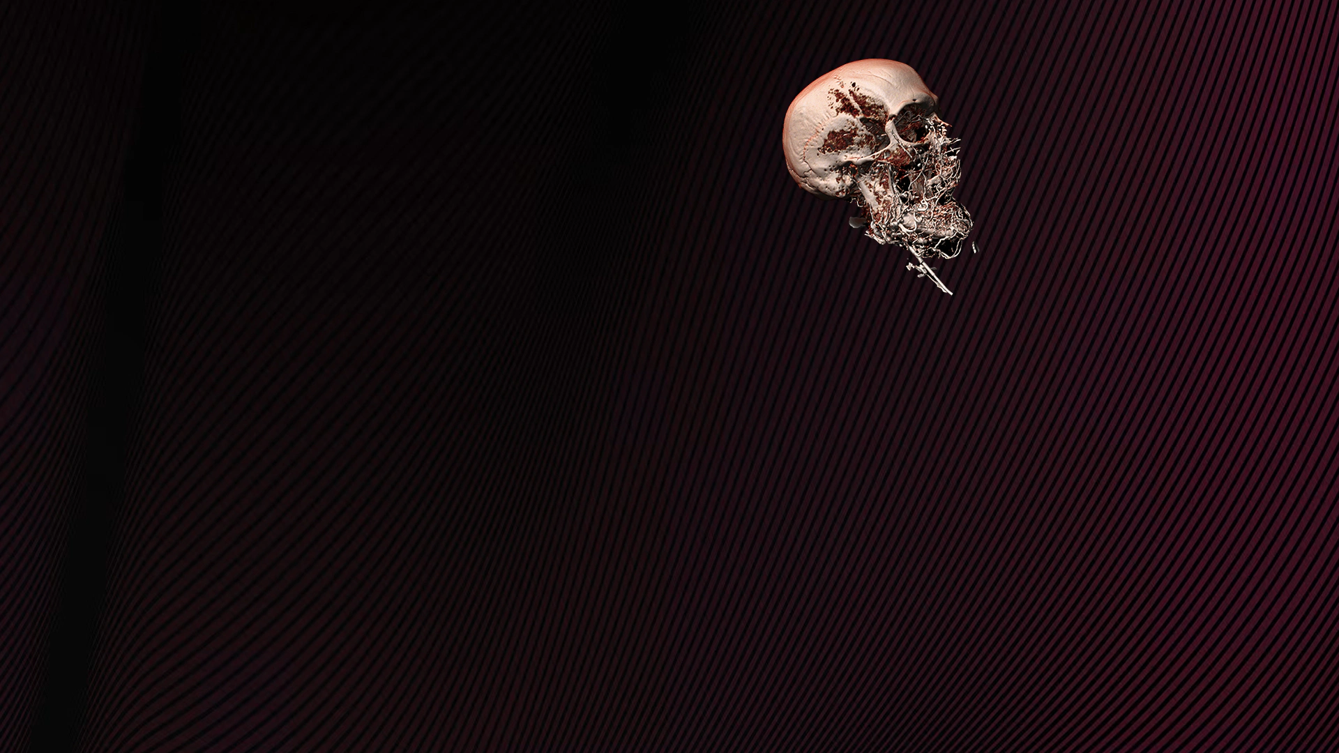 Red panel with skull artery illustration