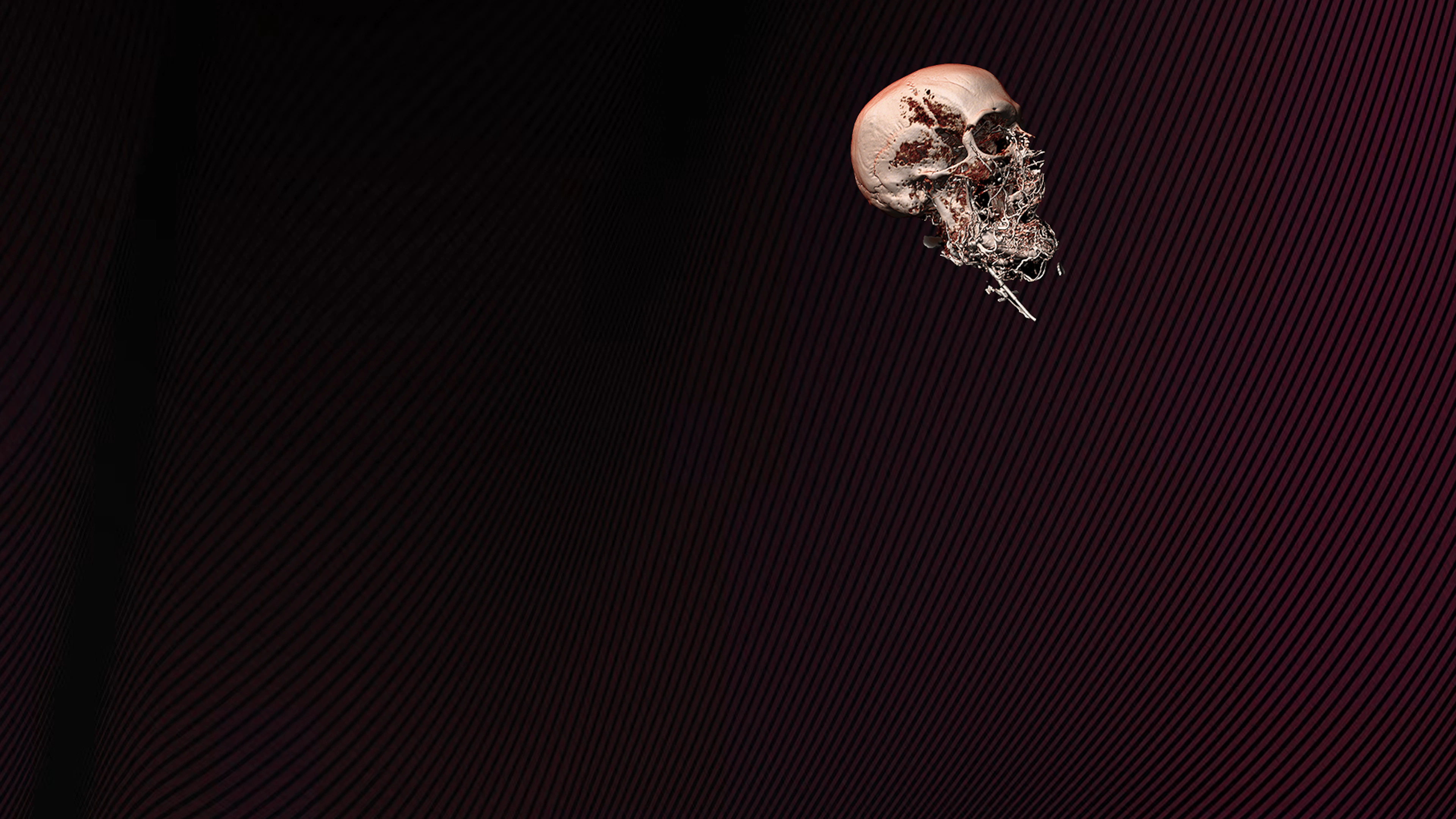 Red panel with skull artery illustration