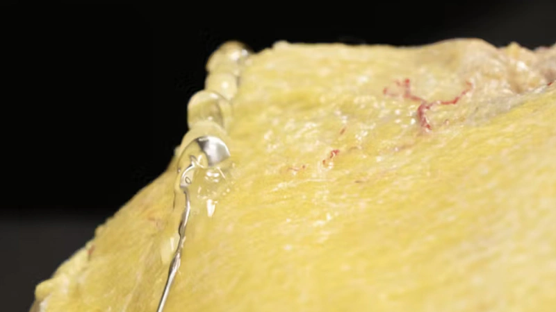 Biostimulator Treatments of the Jawline: Superficial Cannula Technique