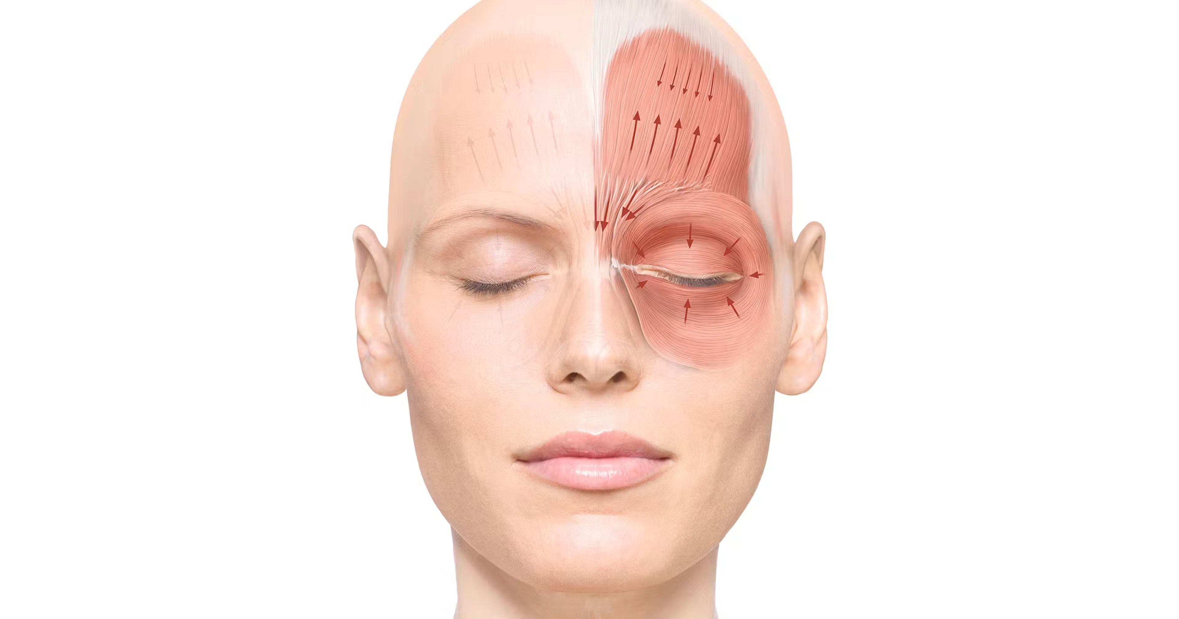 Skin pattern injection techniques illustration