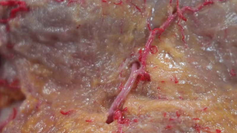 Basic Anatomy and Danger Zones: Chin