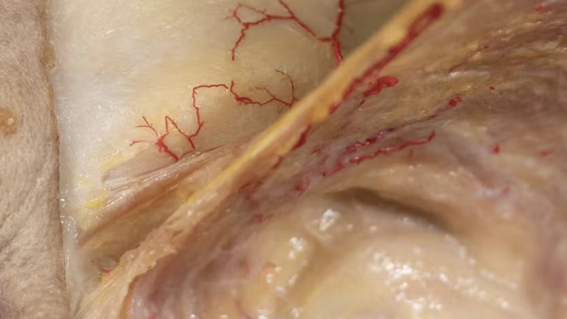 Basic Anatomy for Neuromodulator Treatments: Glabella