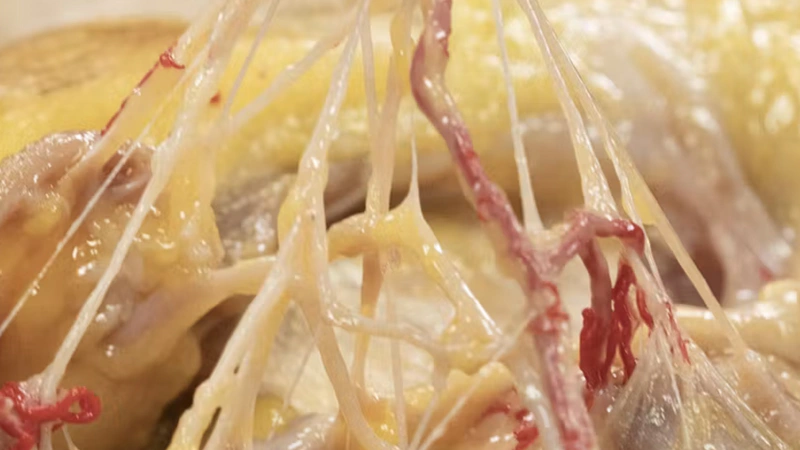 Facial Nerve