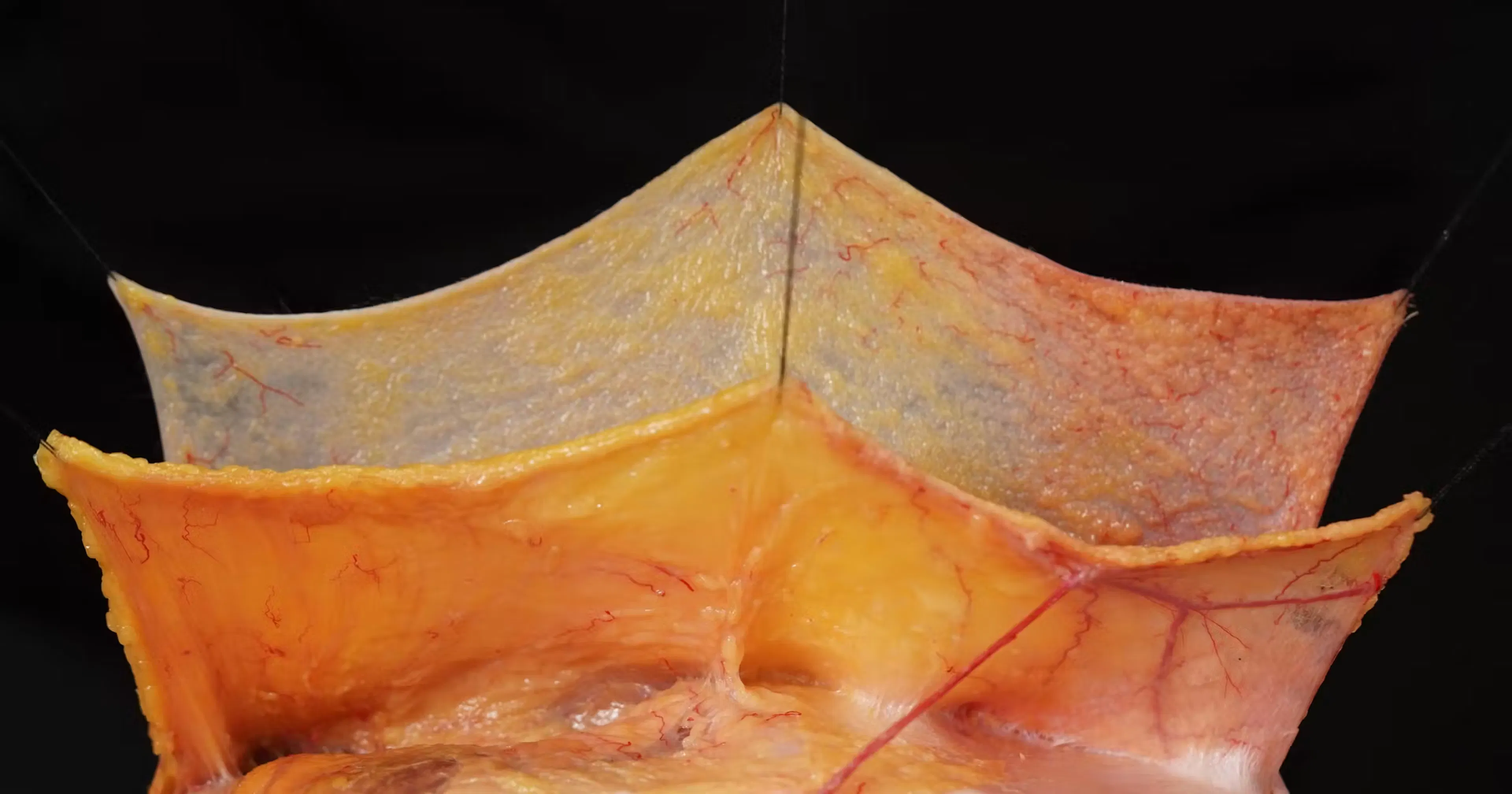 An image of the ligaments of the face
