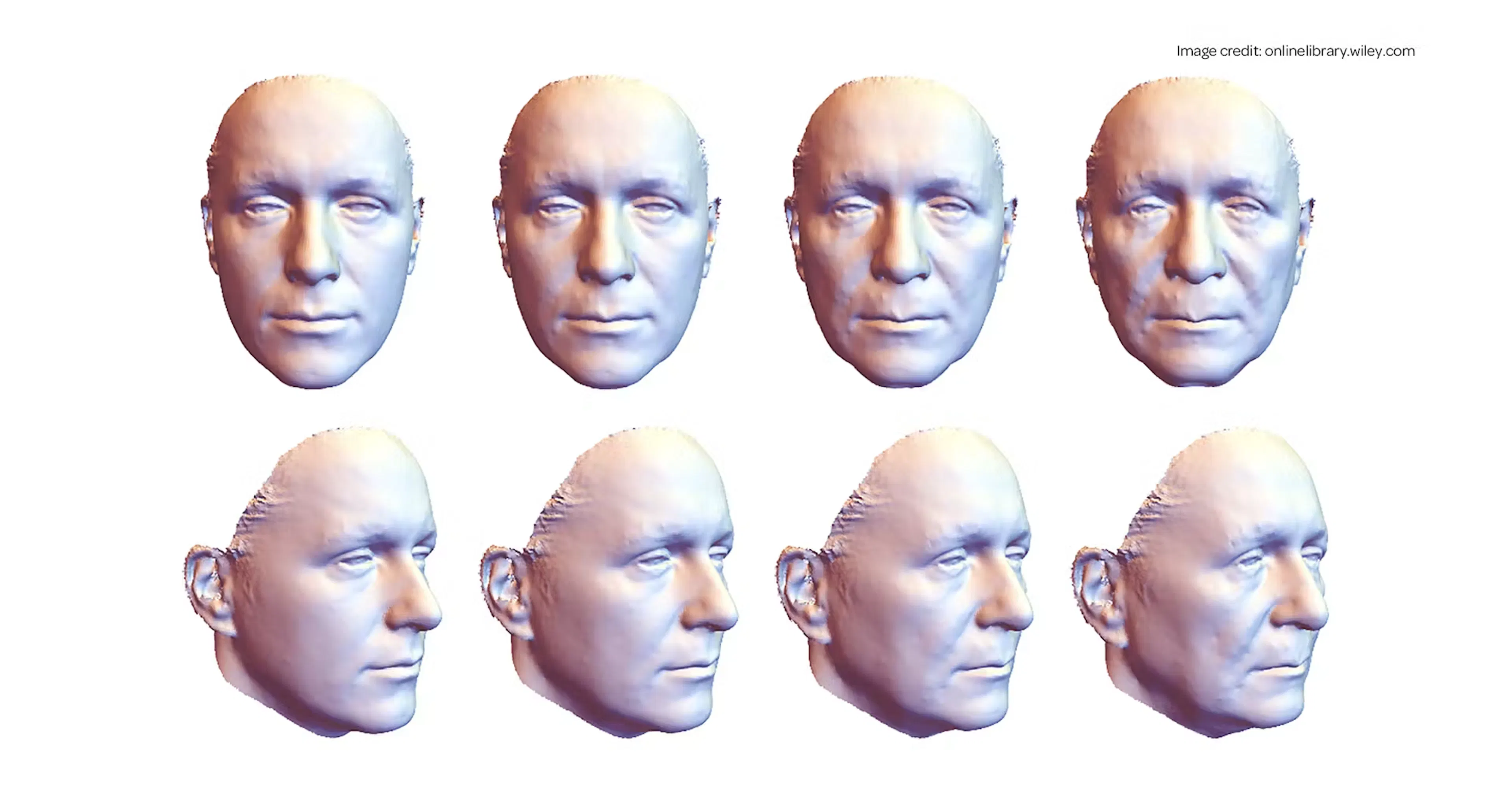 Understanding Facial Aging Through Facial Biomechanics