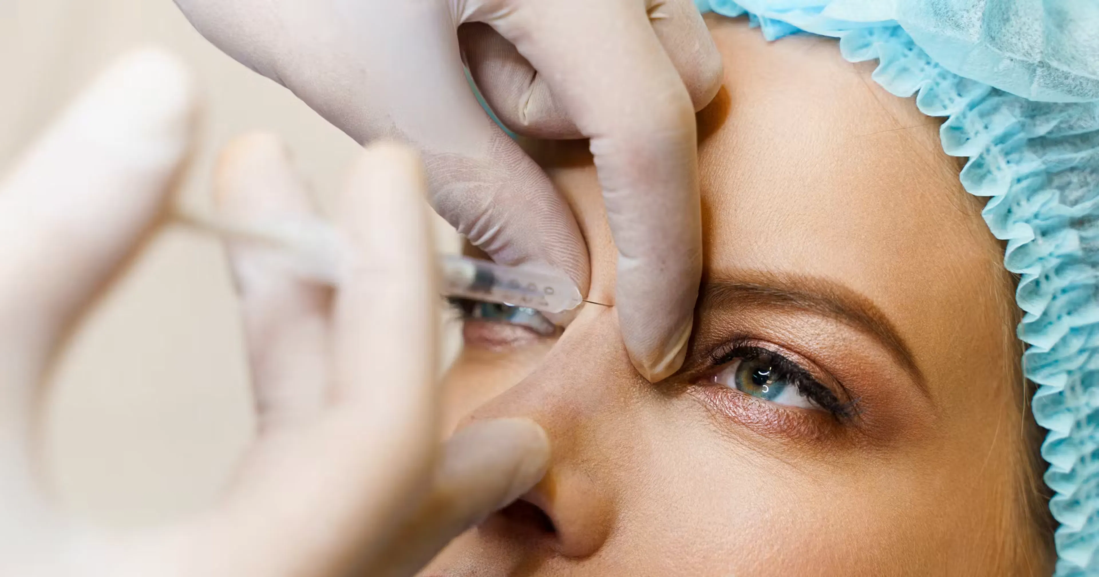 Respecting Upper Facial Anatomy for Treating the Glabella