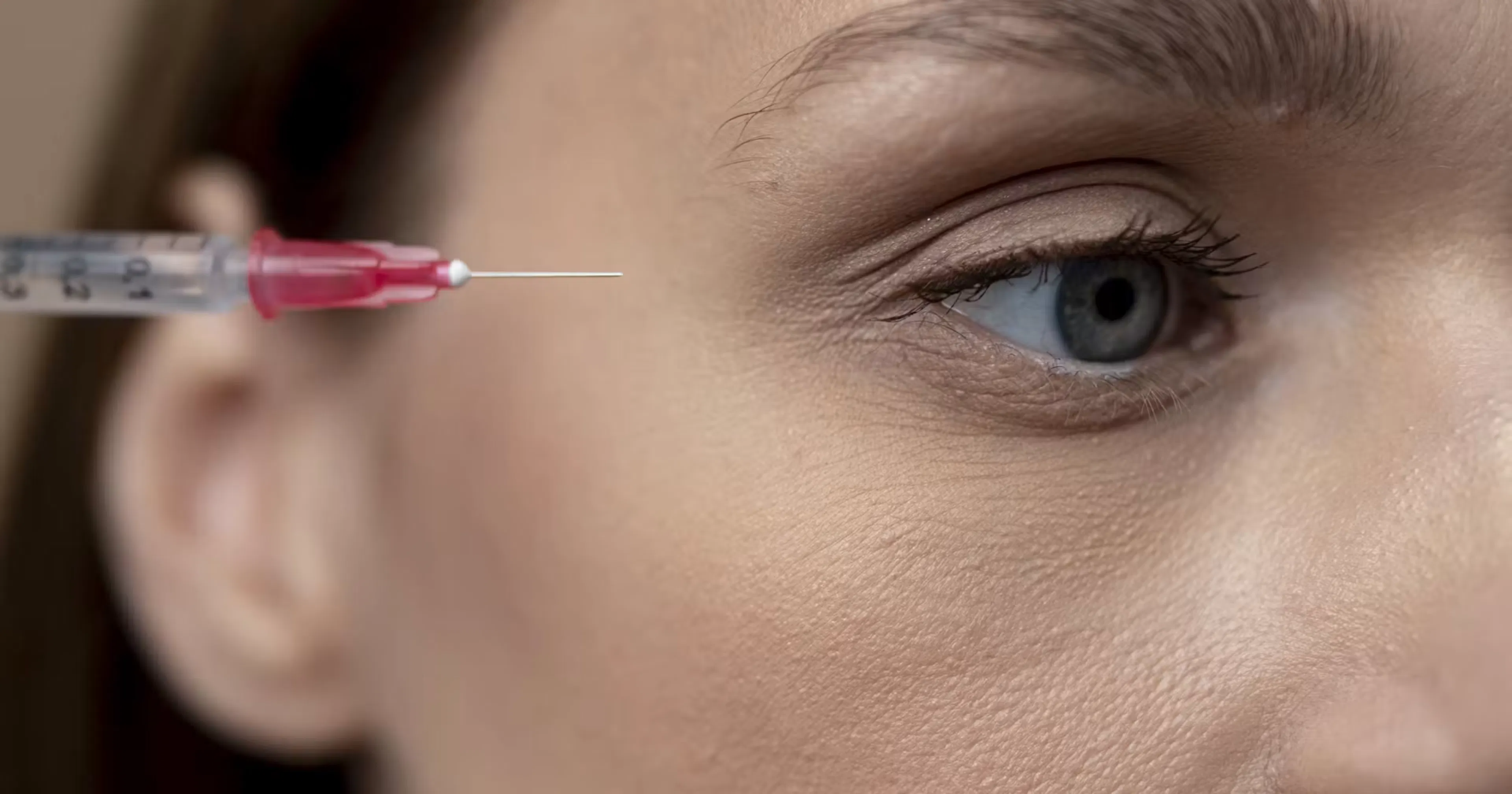 Temple filler injection on a woman