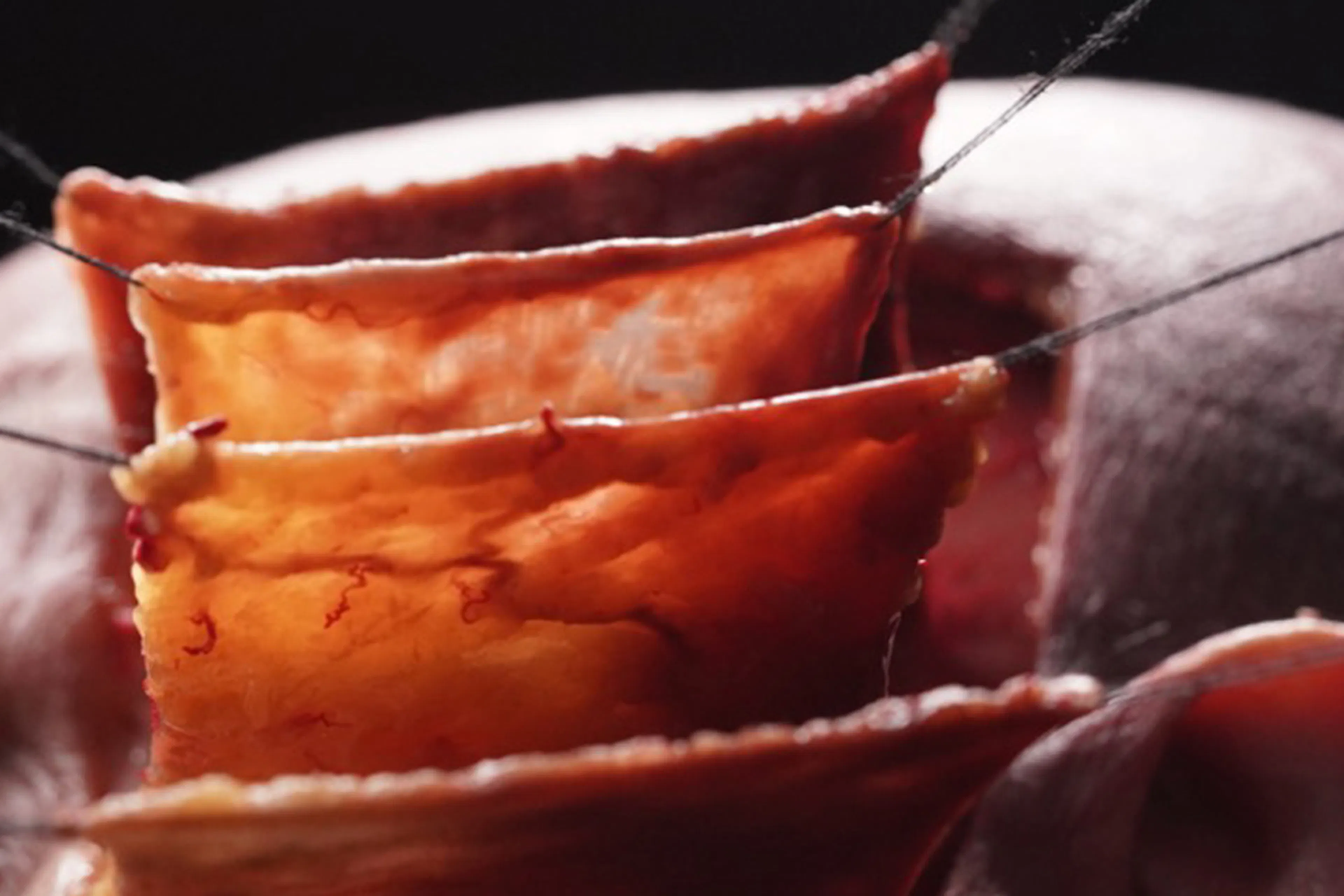 Image of a cadavers head being anatomically investigated