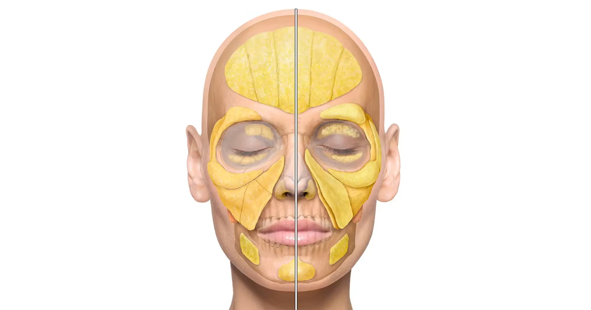 Intermediate Fat Compartments facial schematic